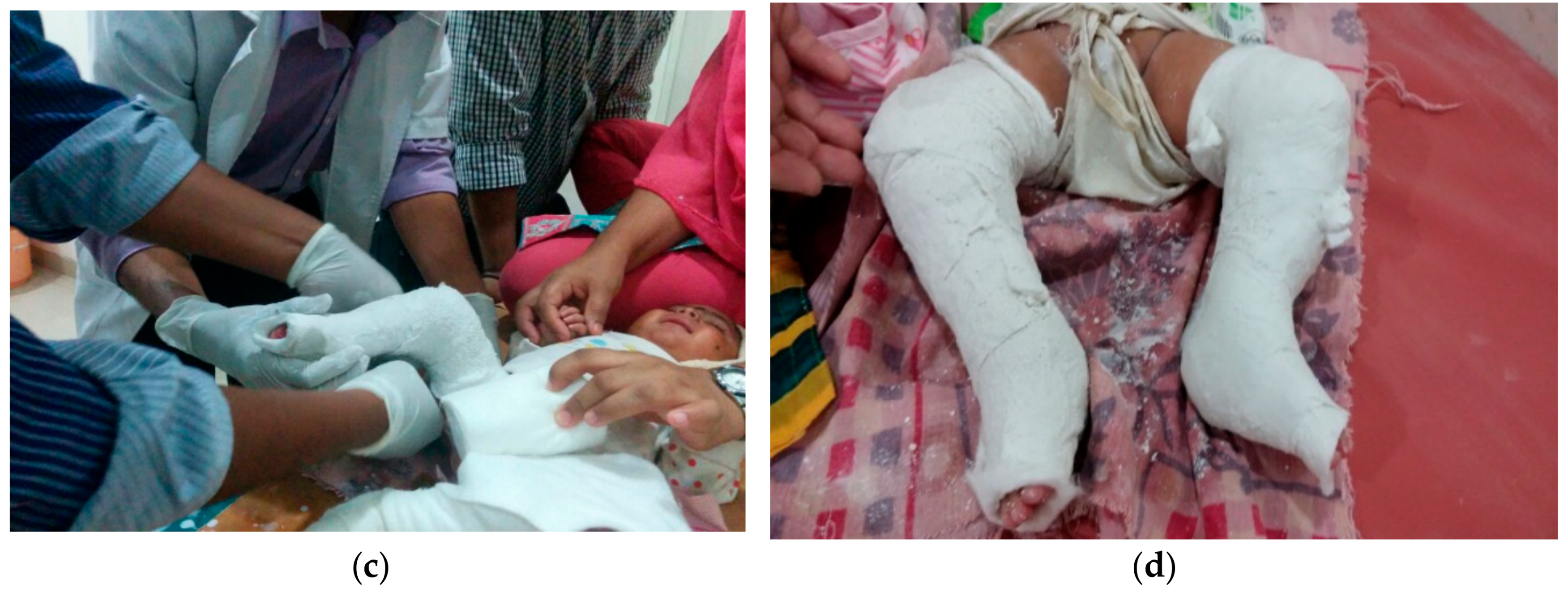 Children 05 00049 g004b