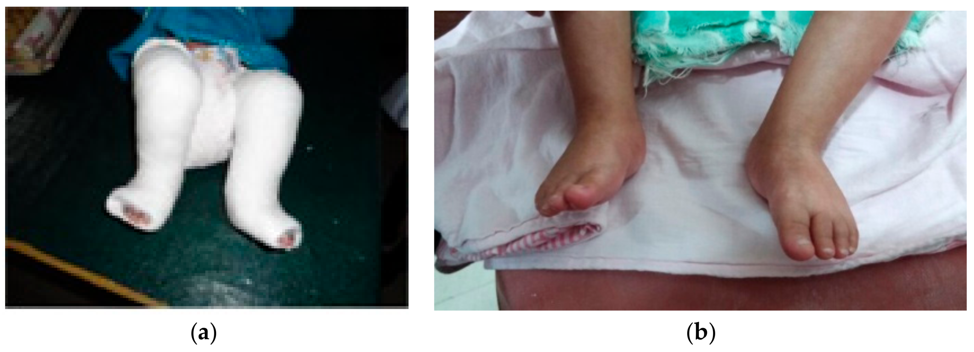 Children 05 00049 g006