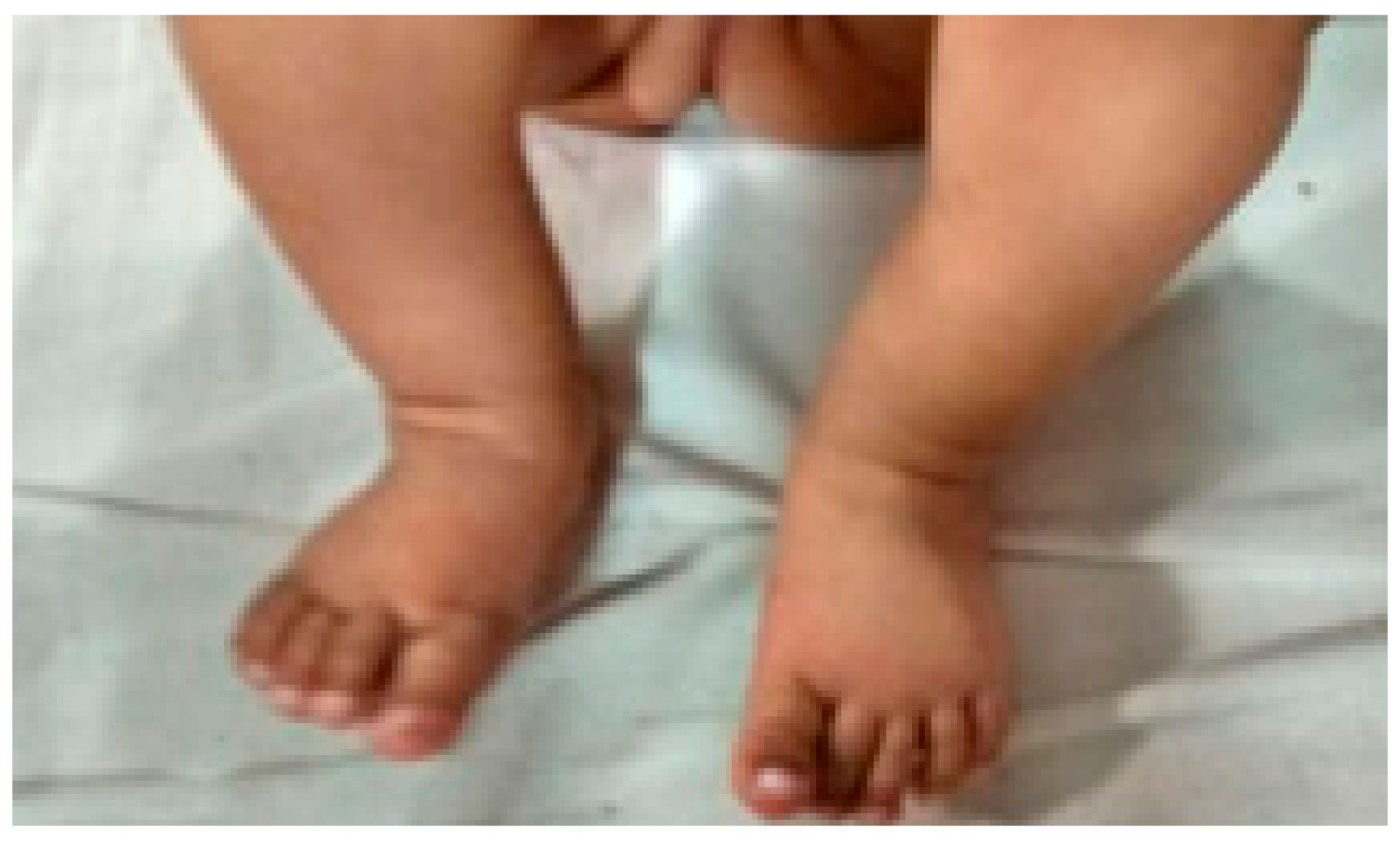 Children 05 00049 g008