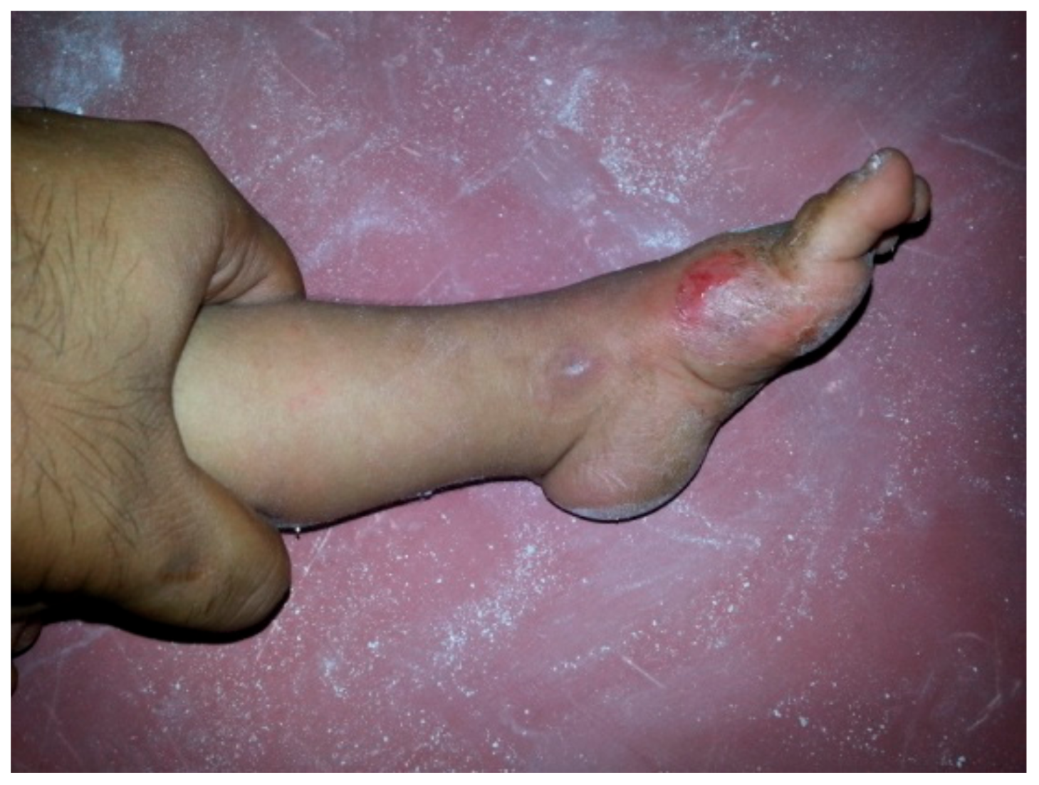 Children 05 00049 g010