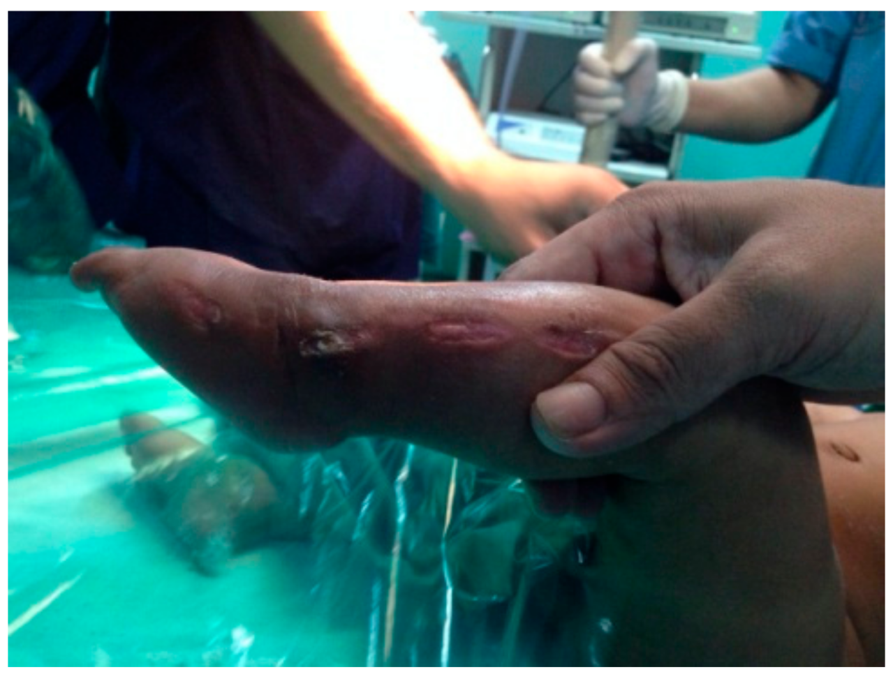 Children 05 00049 g011