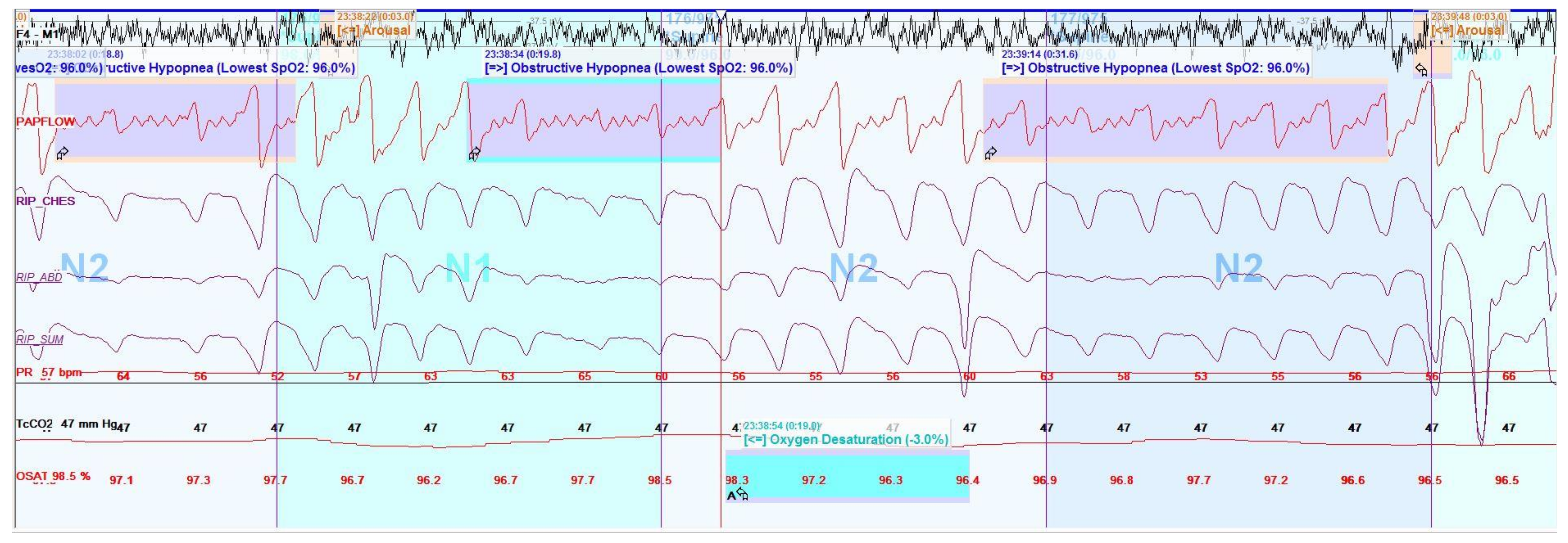 Children 05 00078 g008