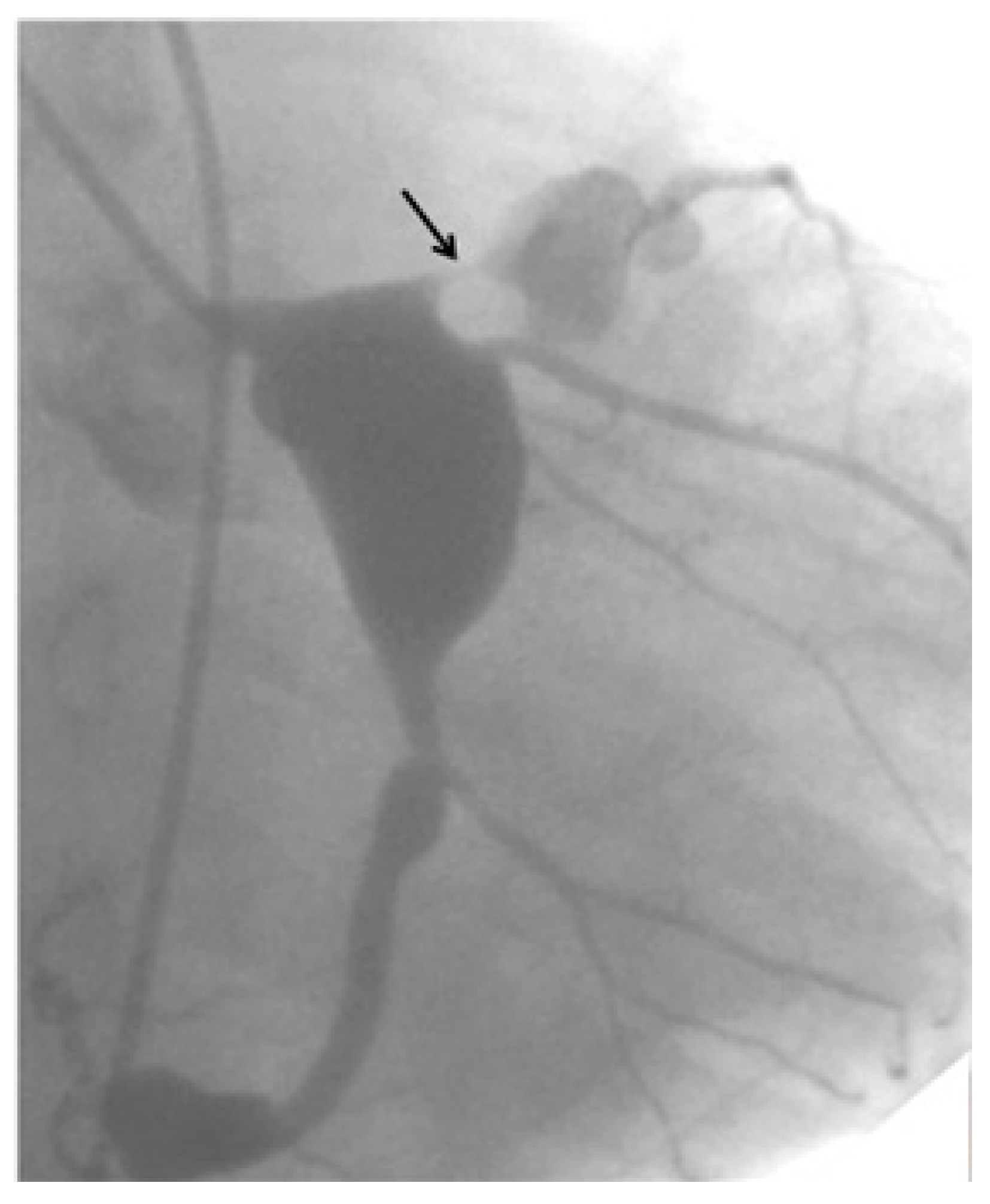 Children 06 00016 g001