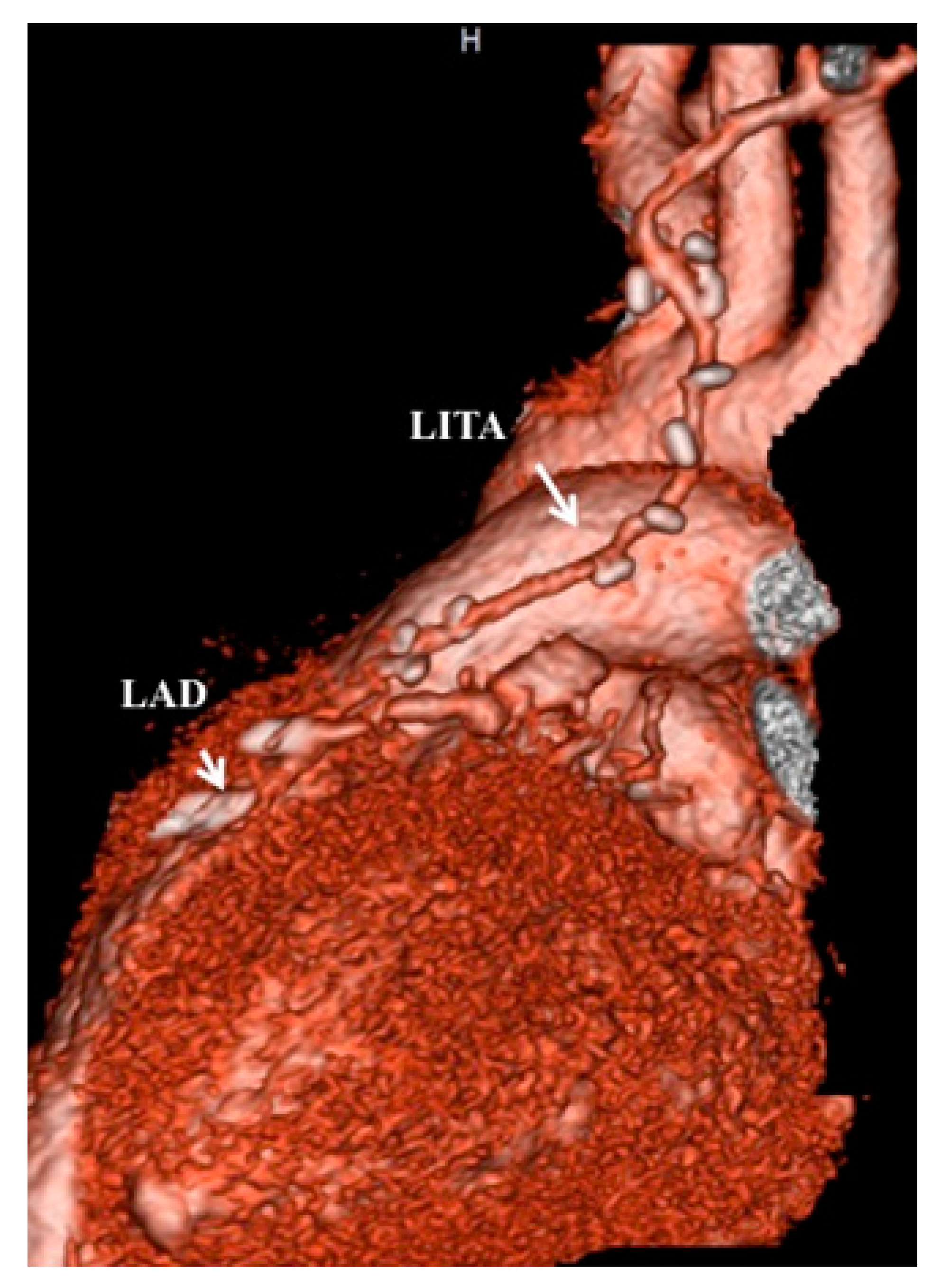 Children 06 00016 g003