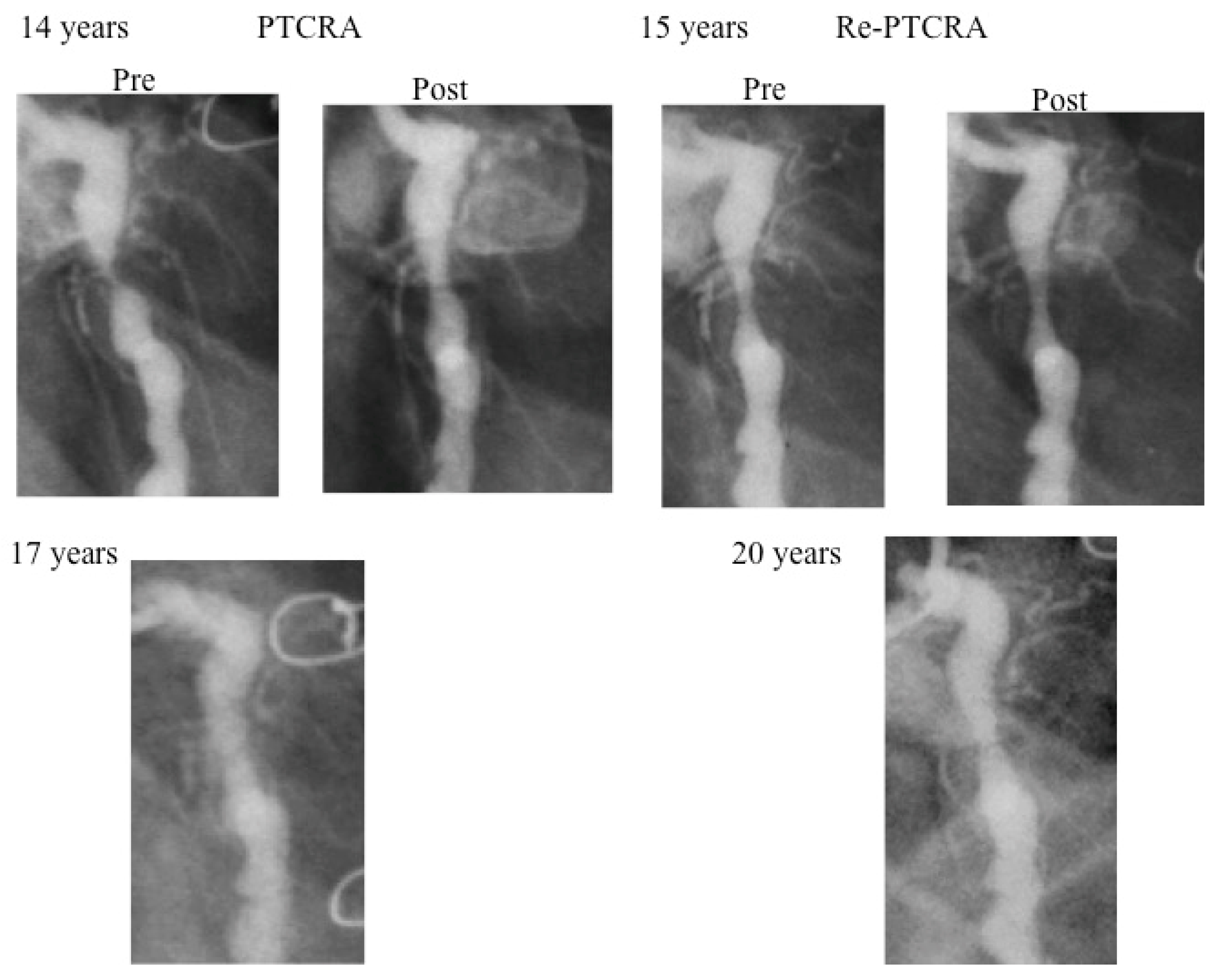 Children 06 00016 g007