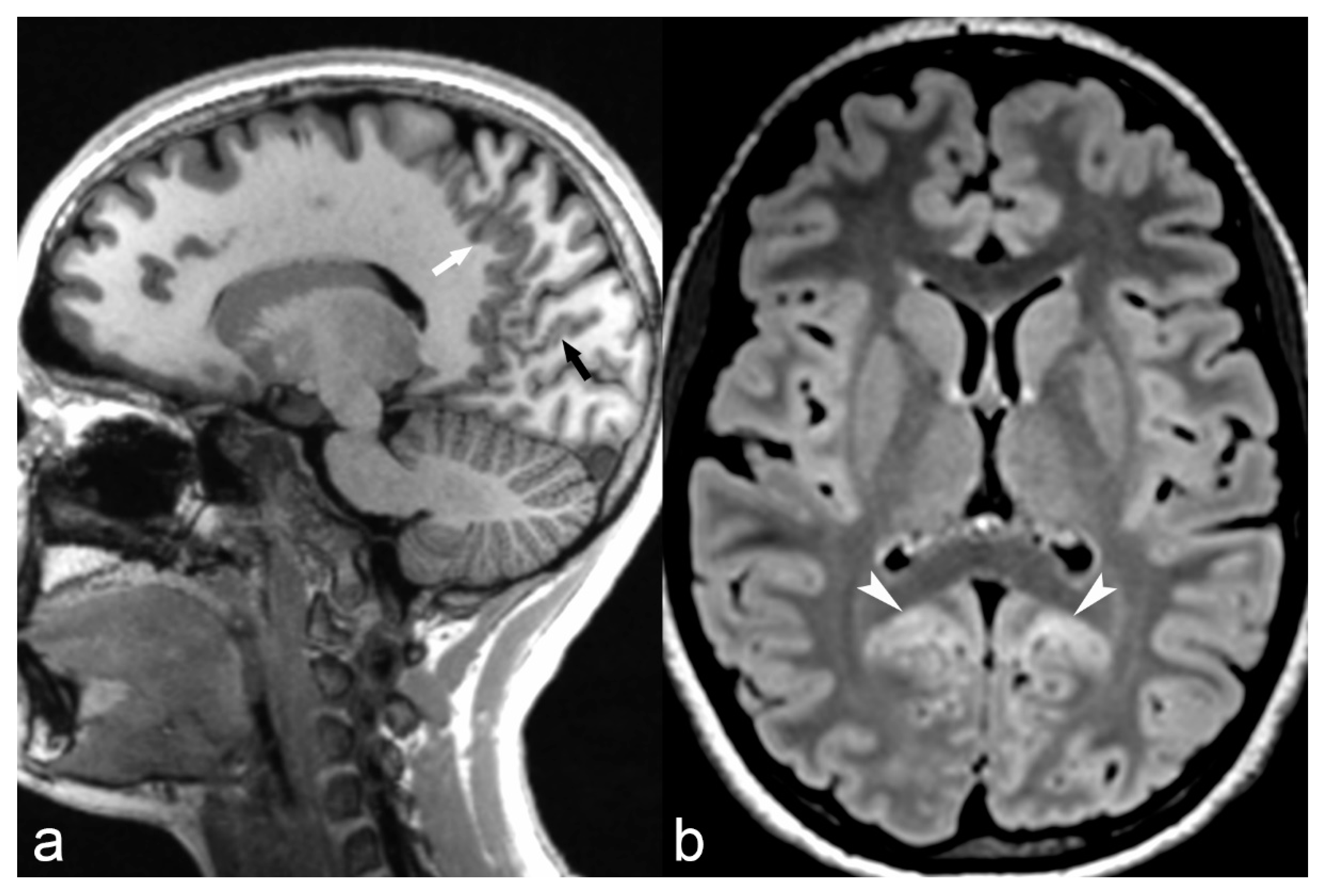 Children 06 00043 g002