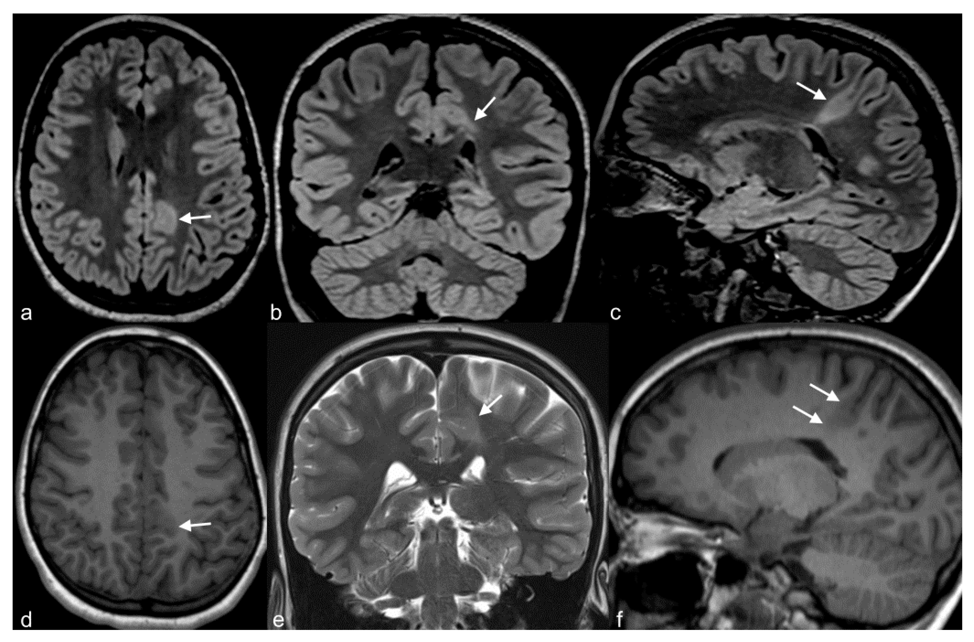 Children 06 00043 g005