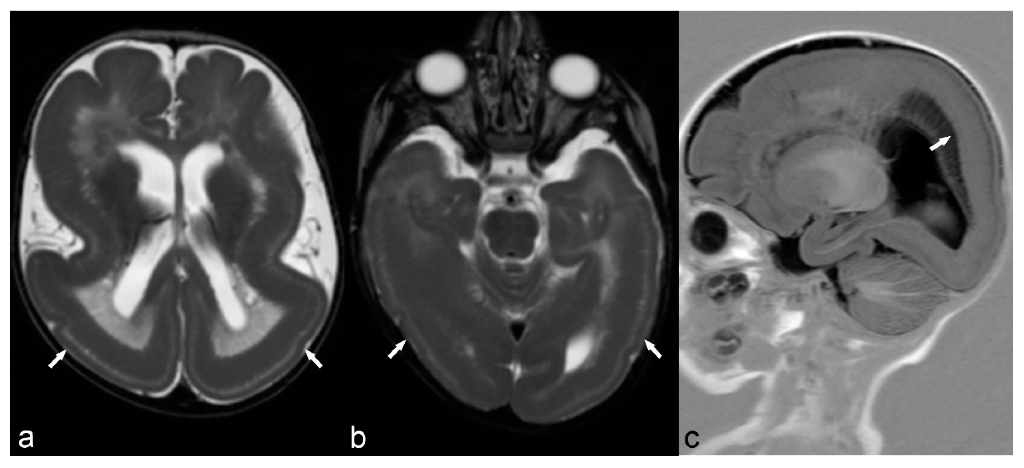 Children 06 00043 g006