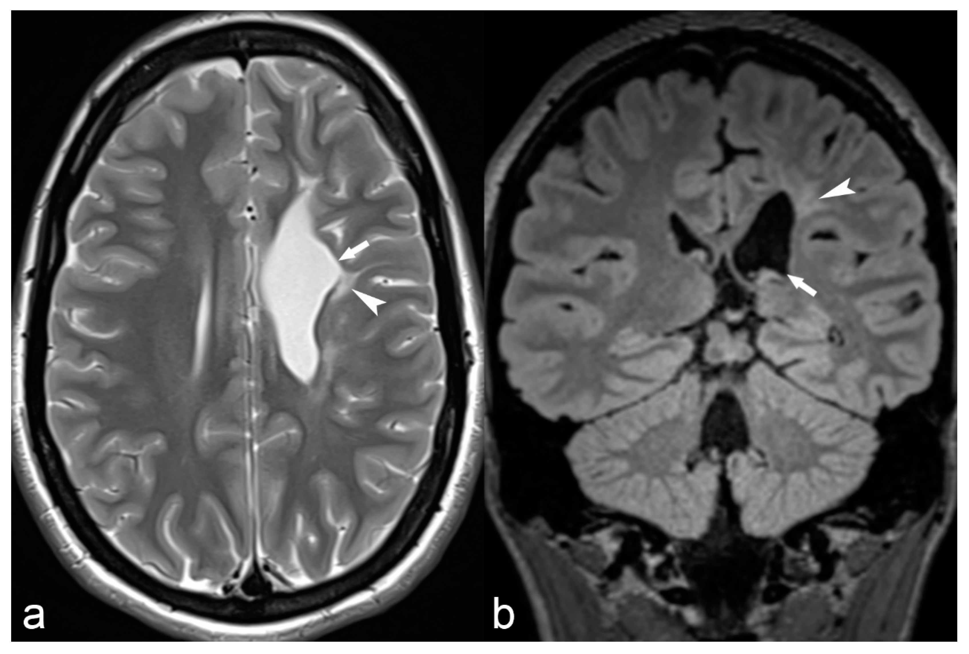 Children 06 00043 g010