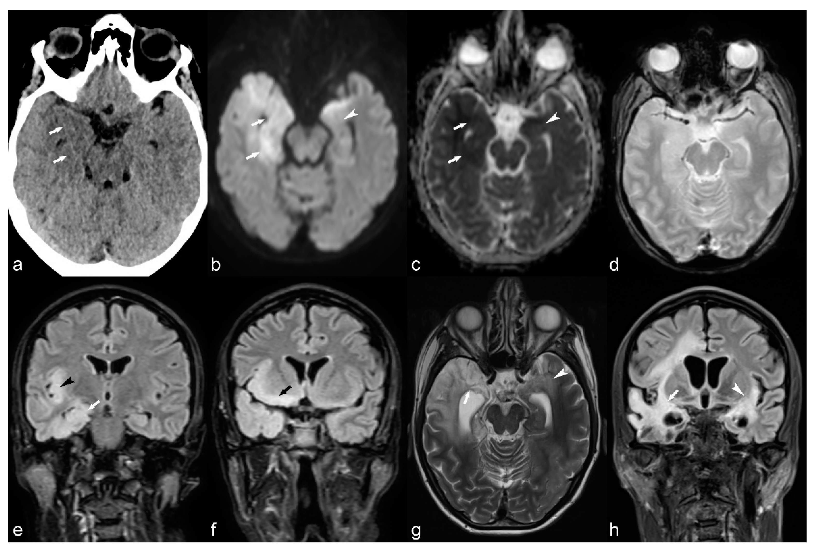 Children 06 00043 g011