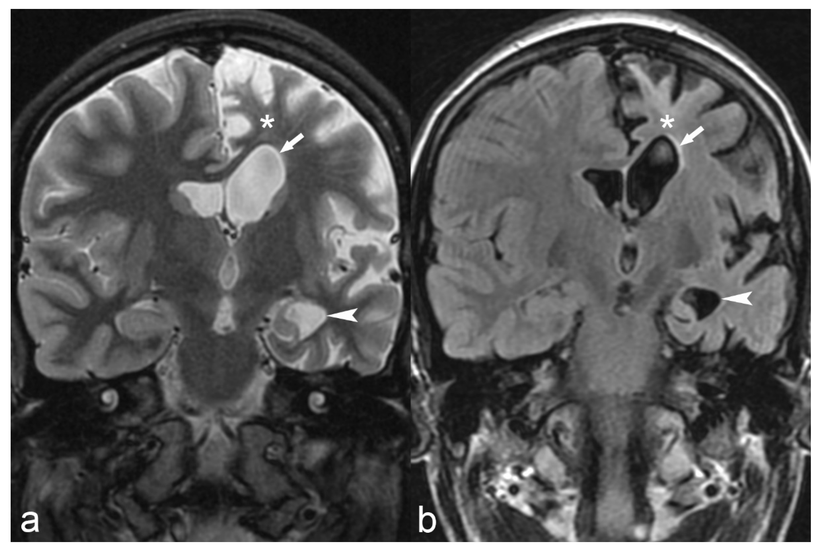 Children 06 00043 g012