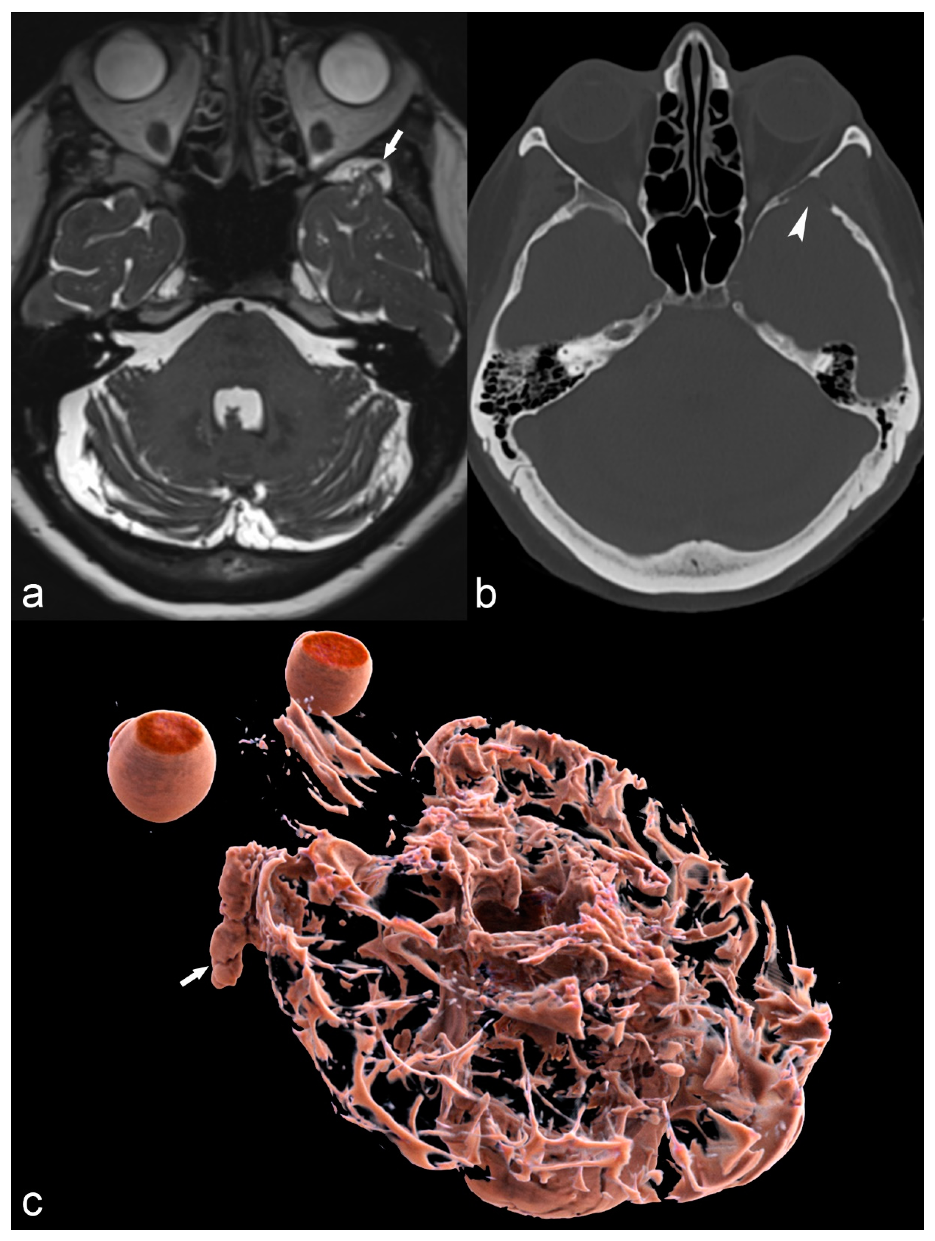 Children 06 00043 g014