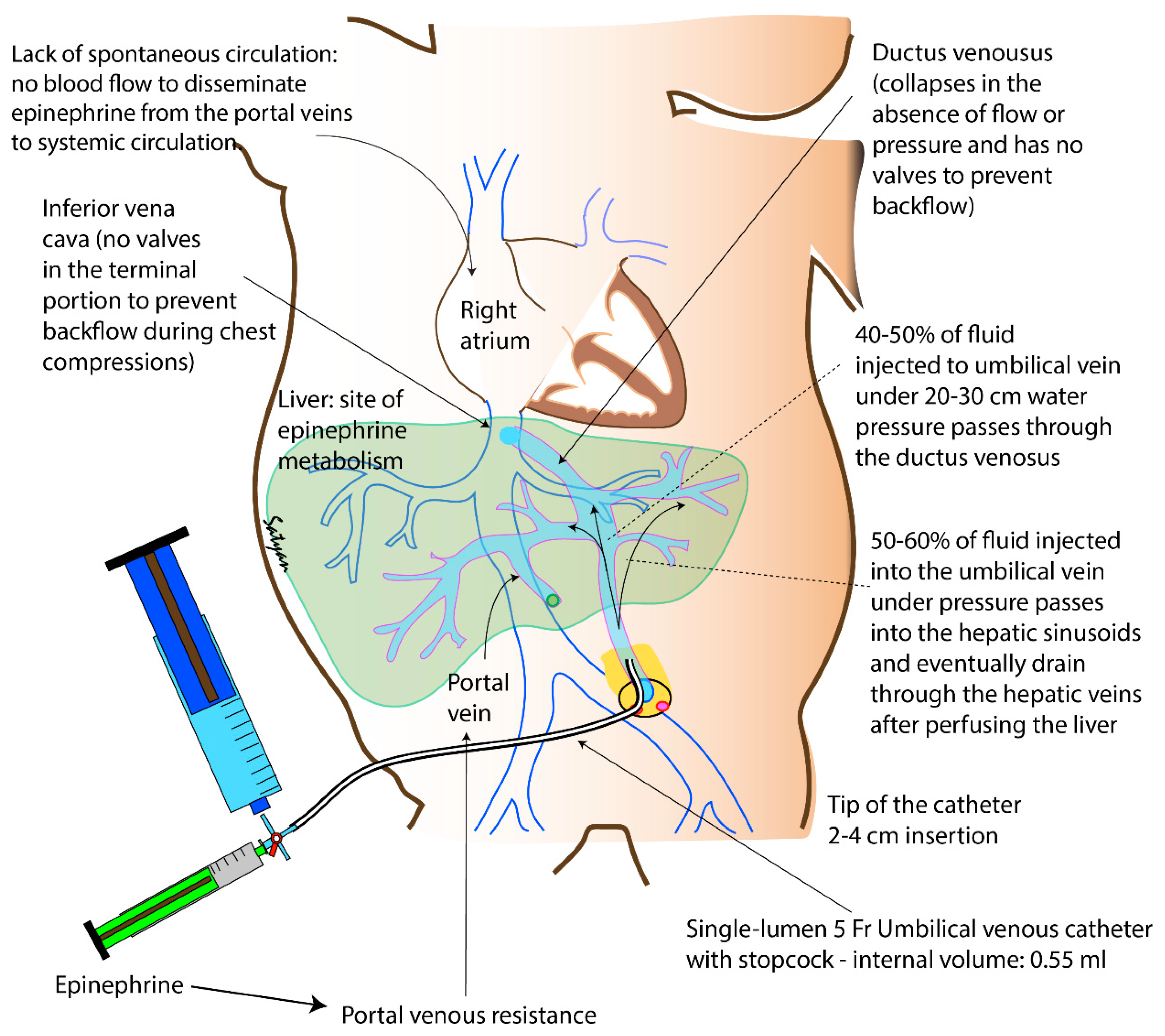 Children 06 00051 g003