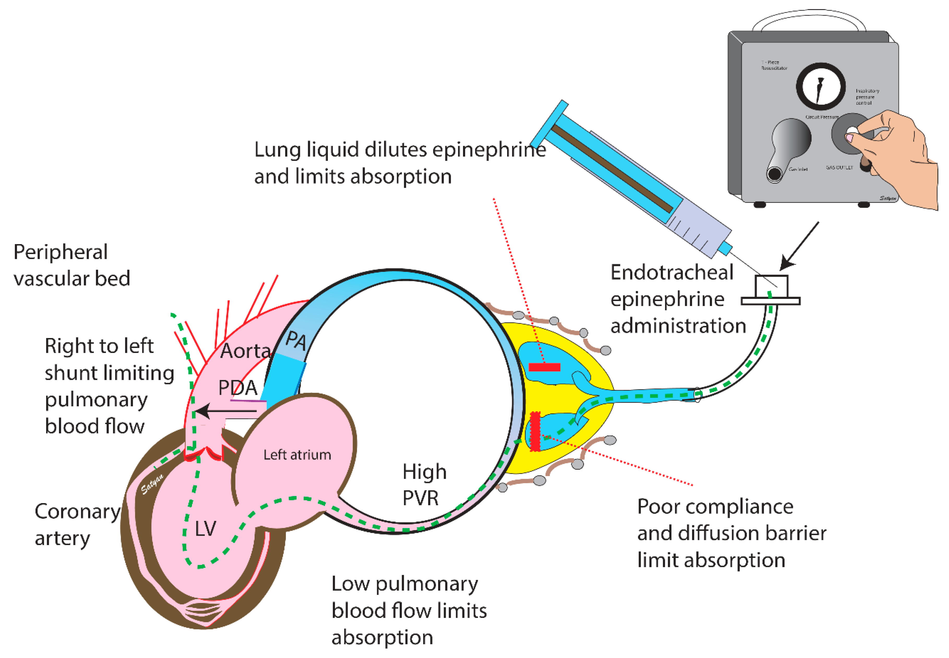 Children 06 00051 g004