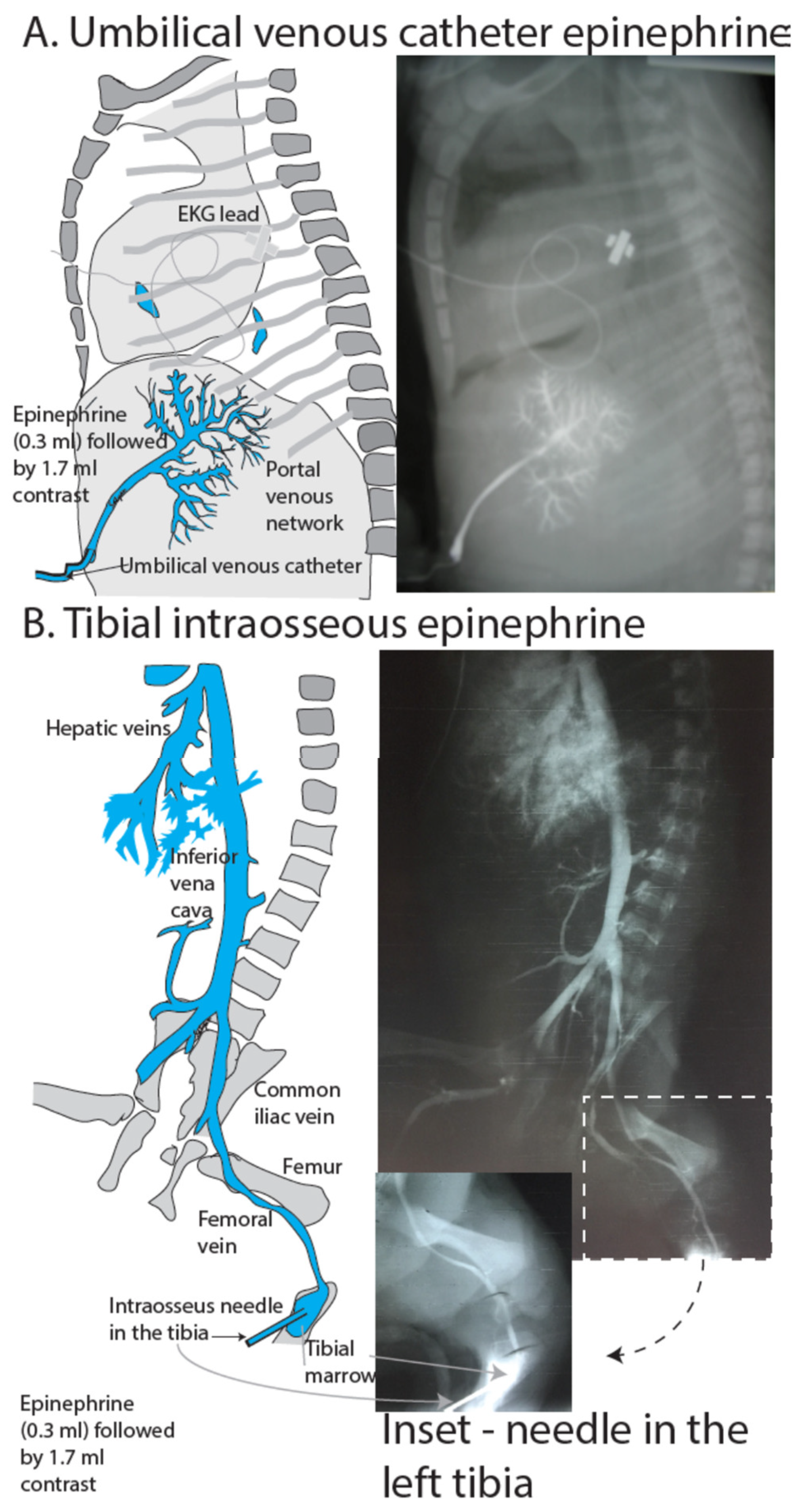 Children 06 00051 g005