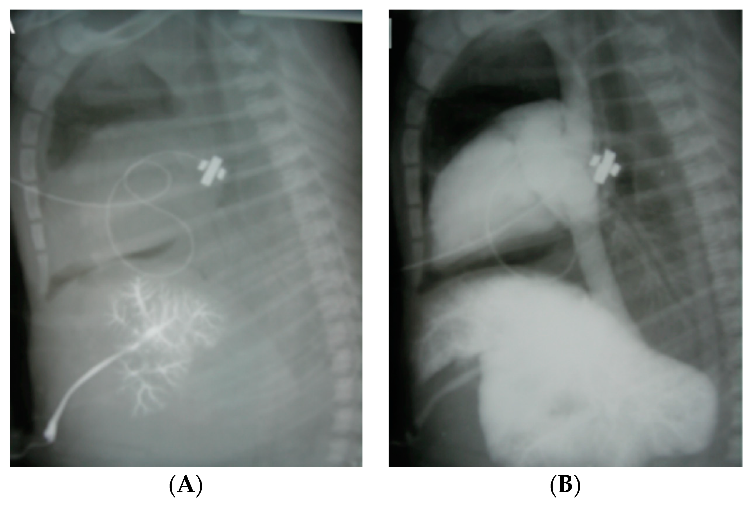 Children 06 00051 g006