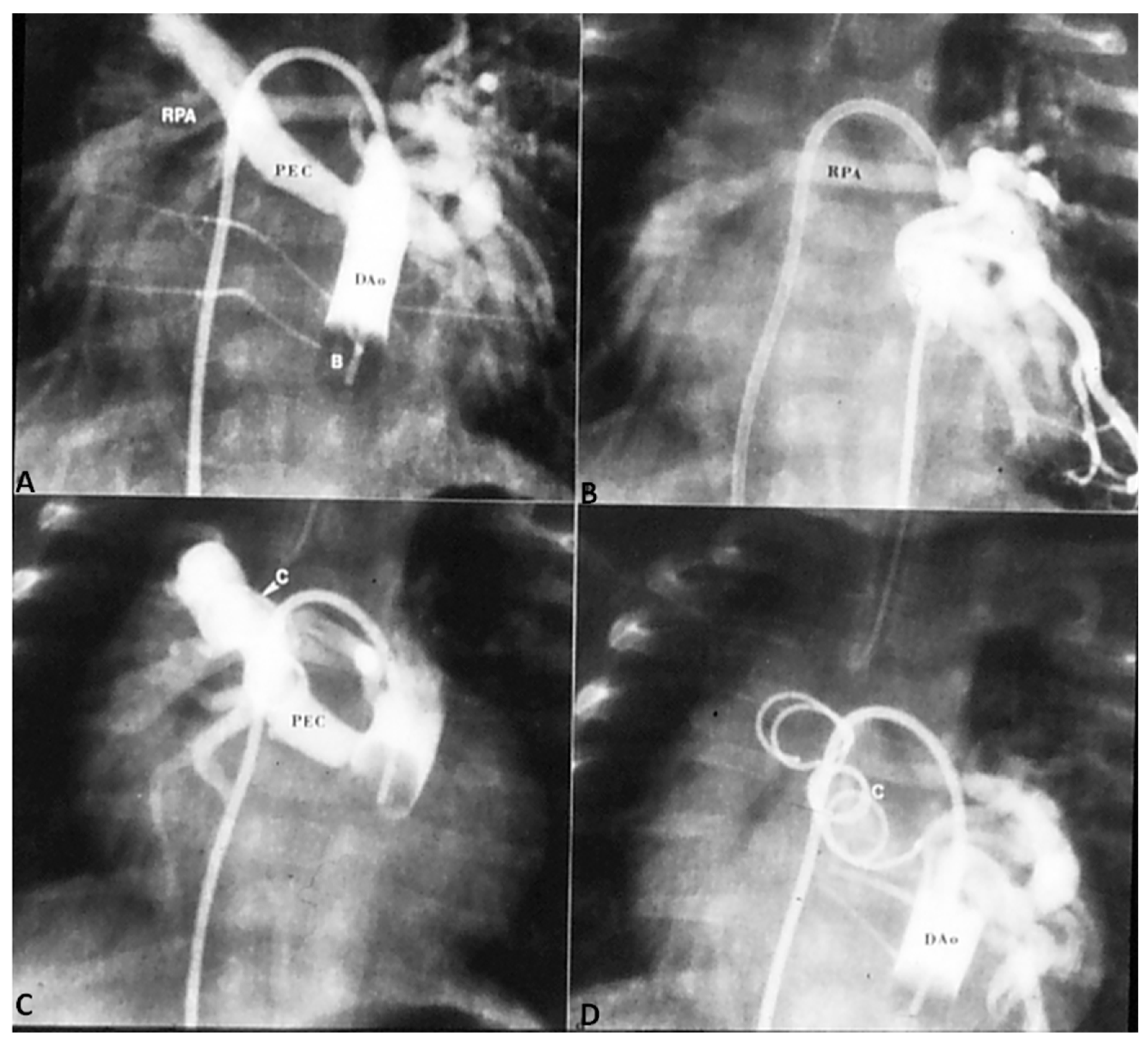 Children 06 00054 g004