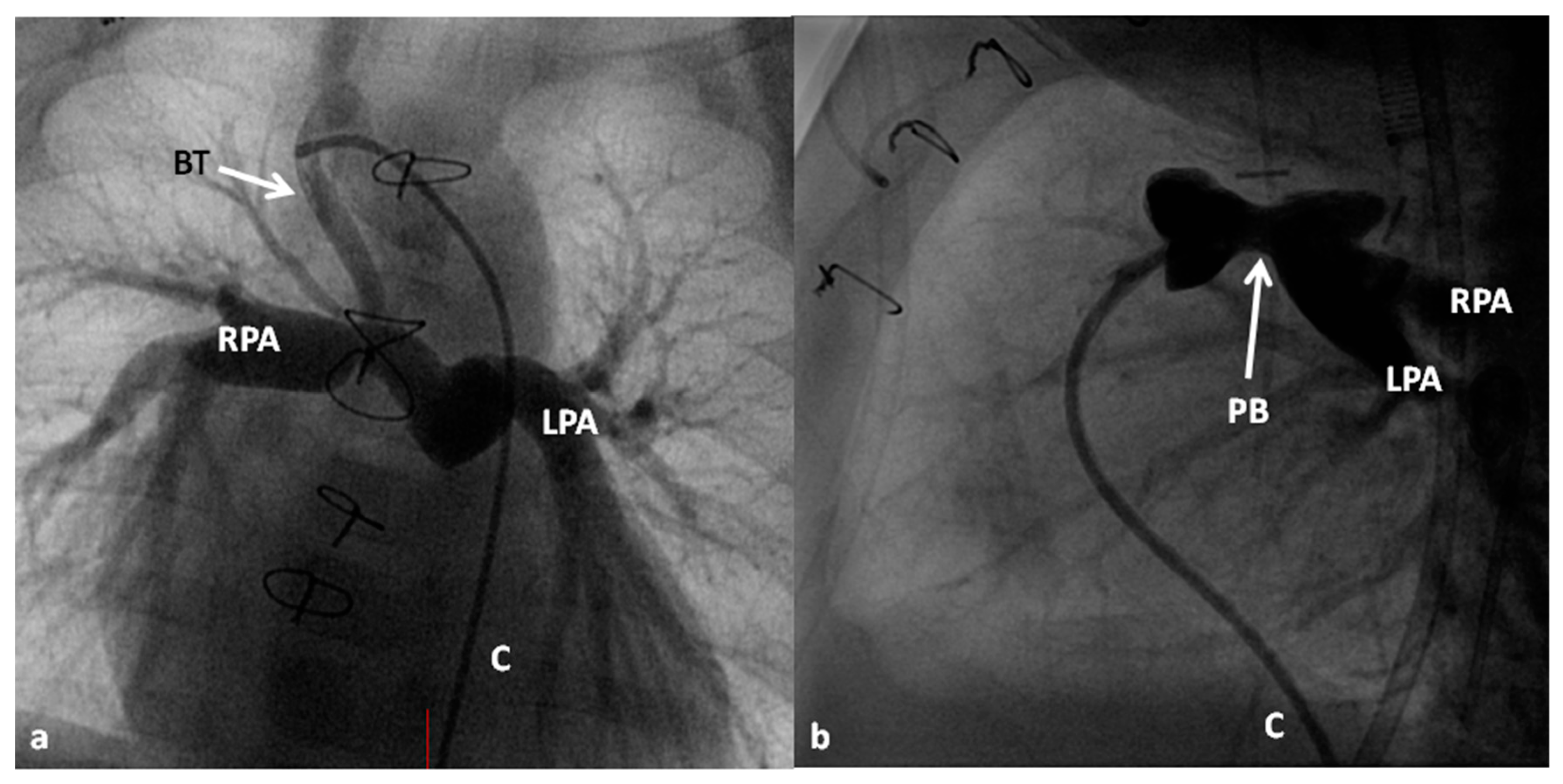 Children 06 00054 g007