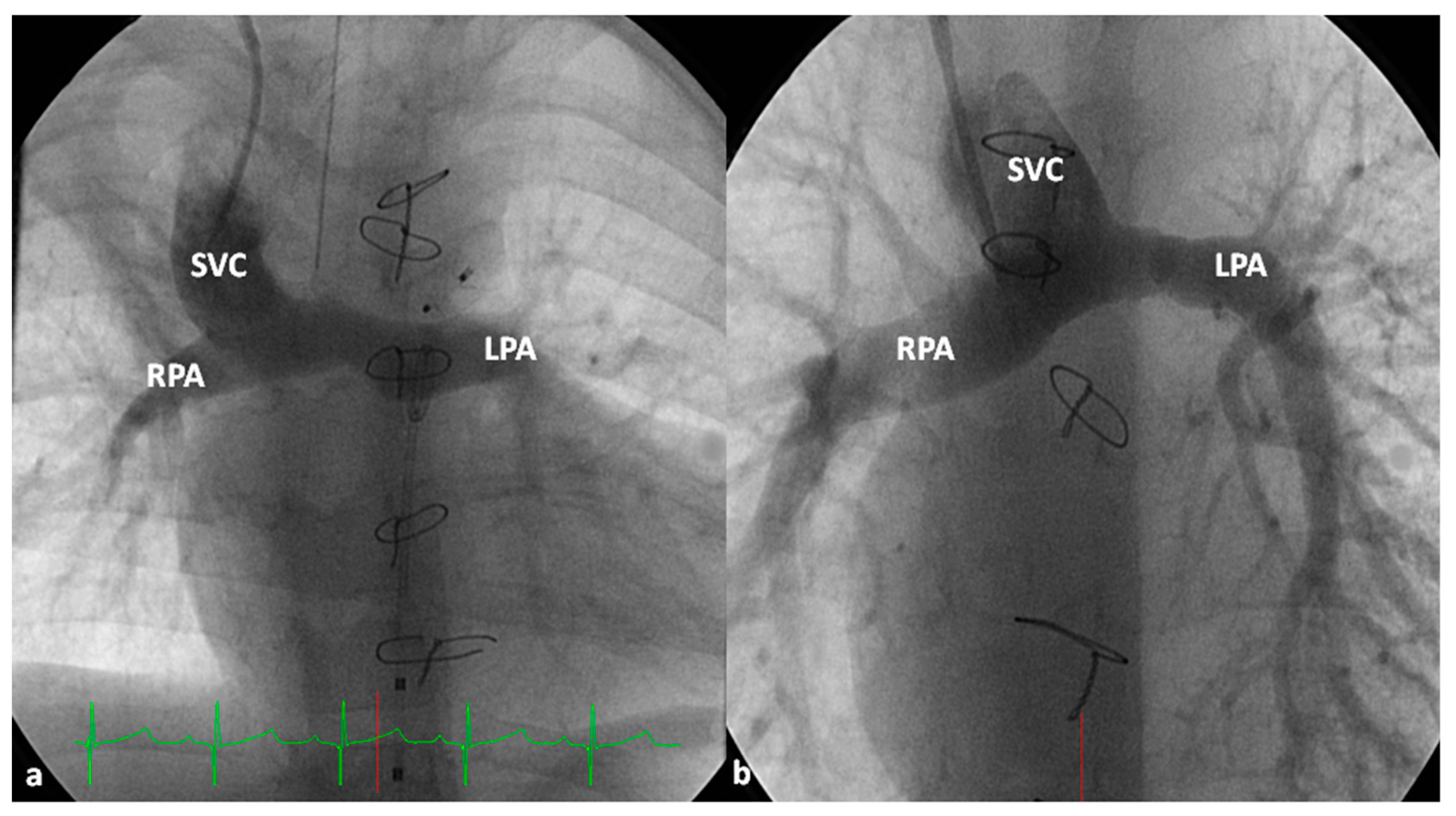 Children 06 00054 g008