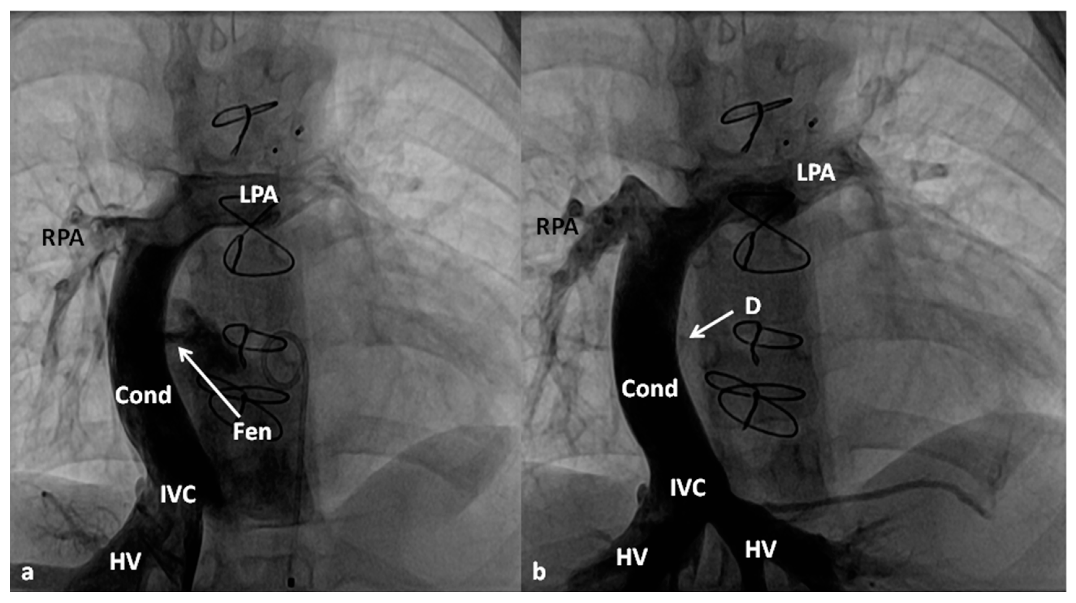 Children 06 00054 g011