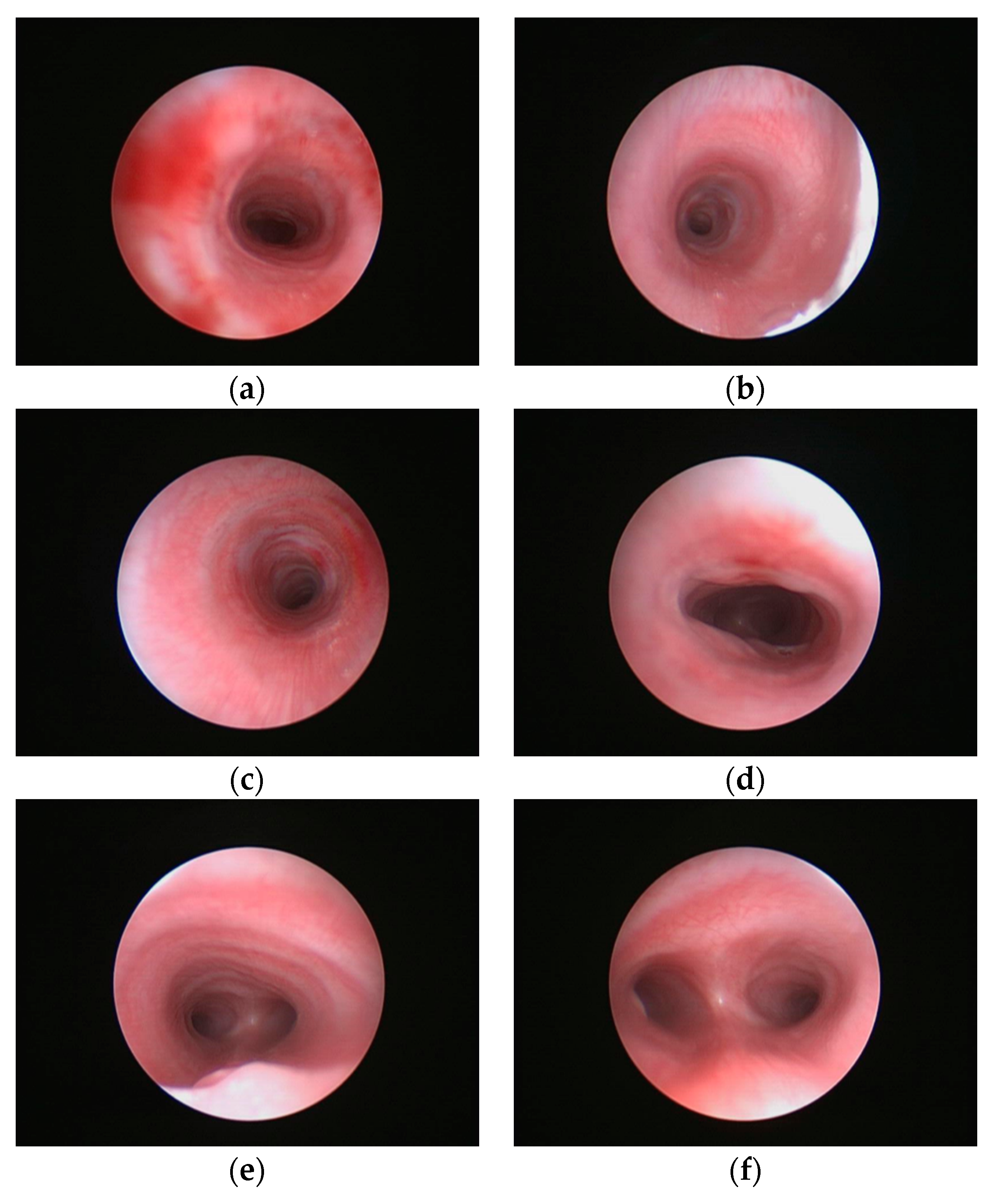 Children 06 00098 g001