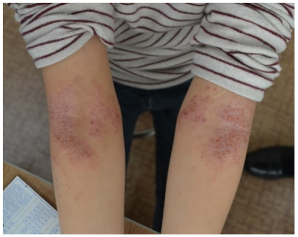 Children 06 00133 i001