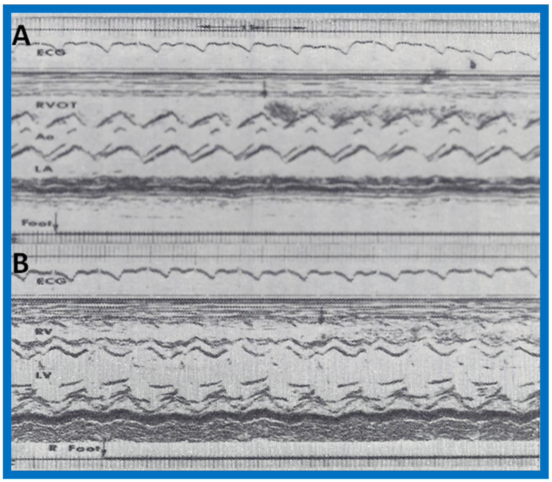 Children 07 00032 g005