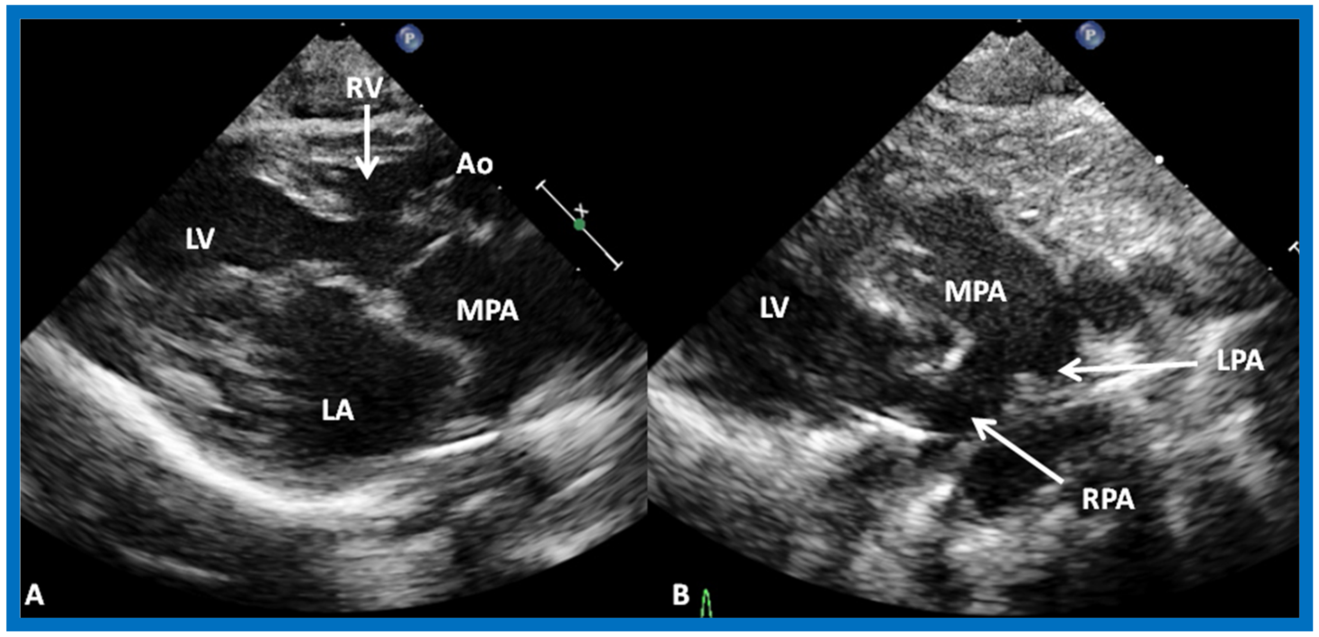 Children 07 00032 g021