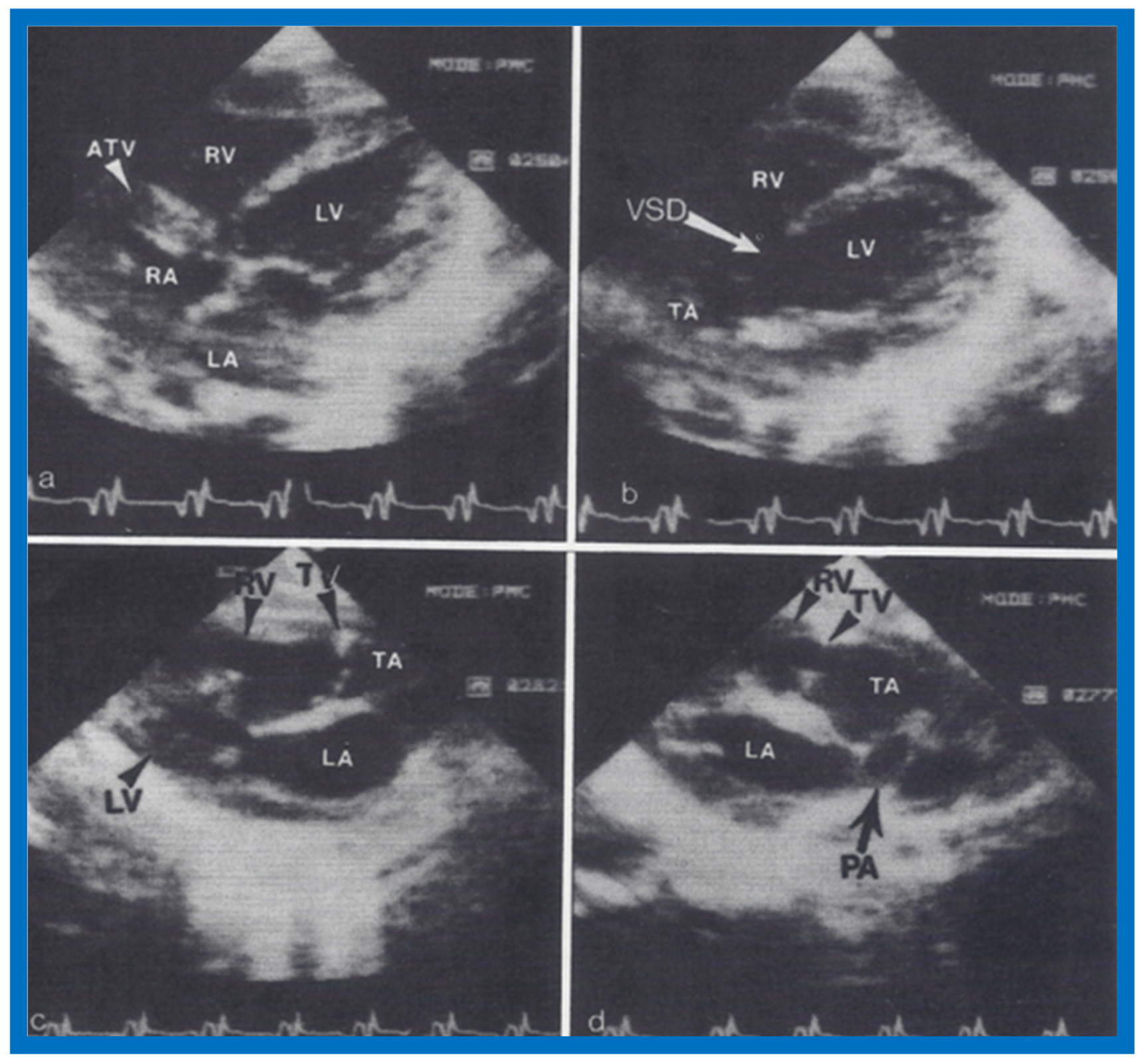 Children 07 00032 g023