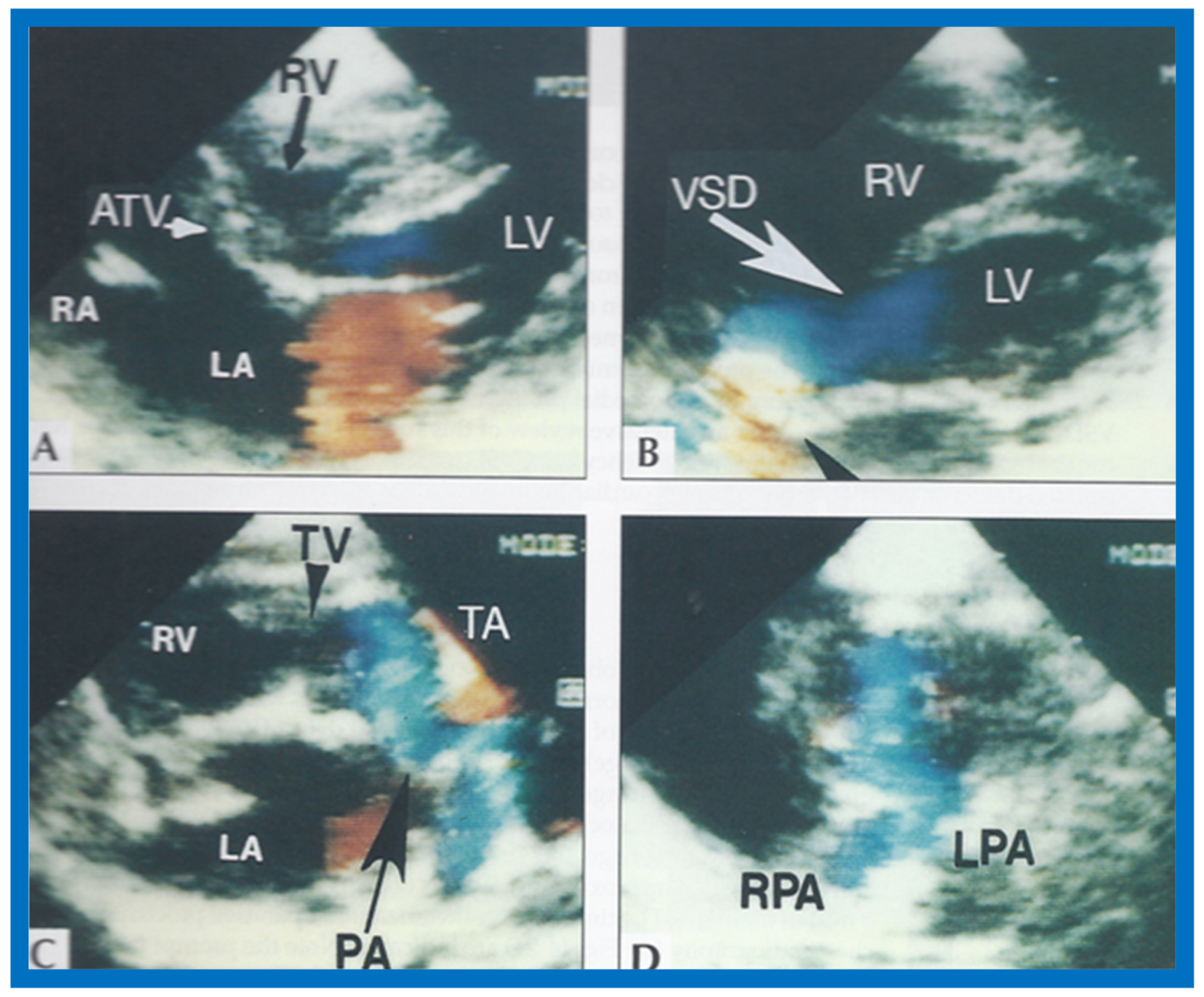 Children 07 00032 g024