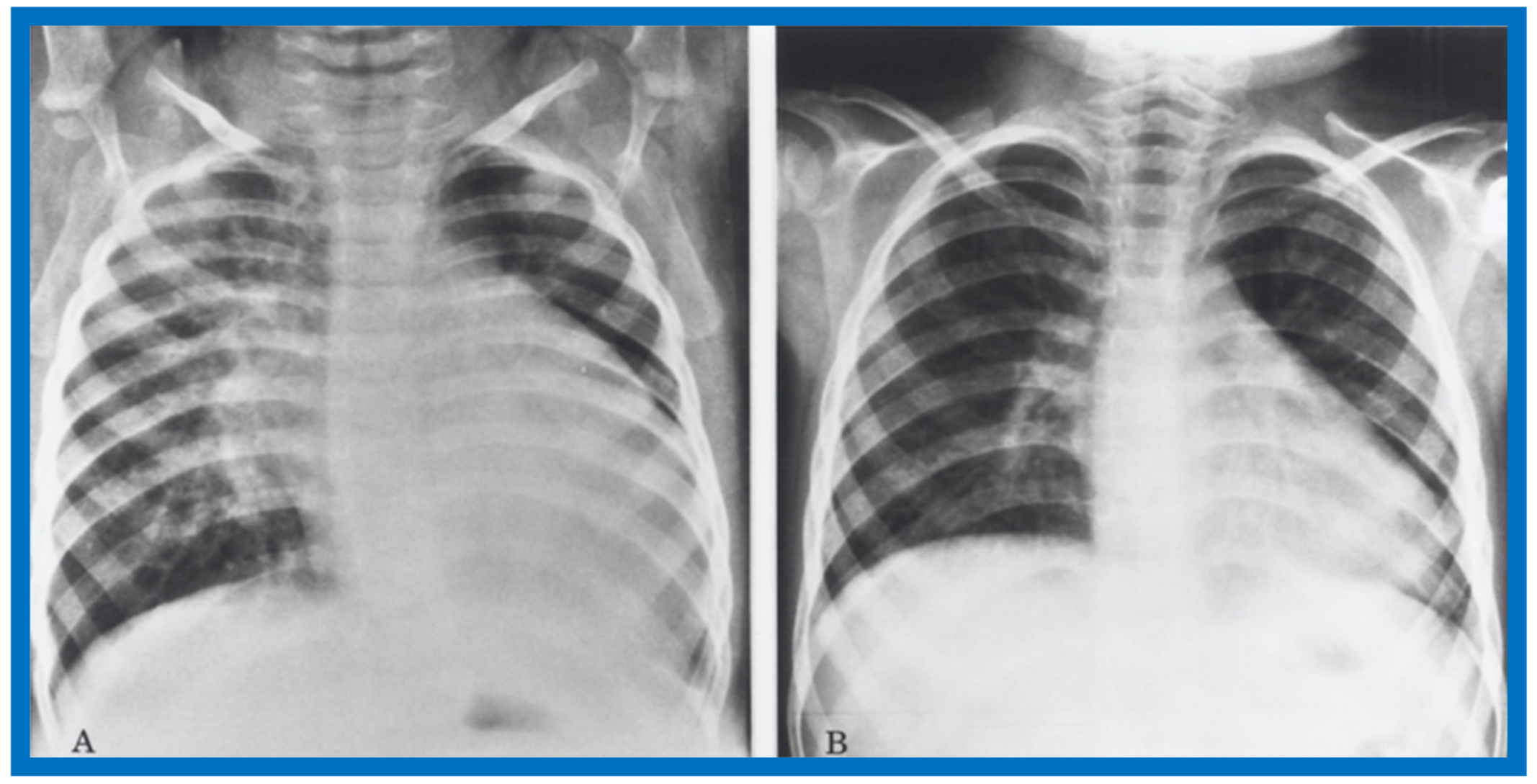 Children 07 00032 g042