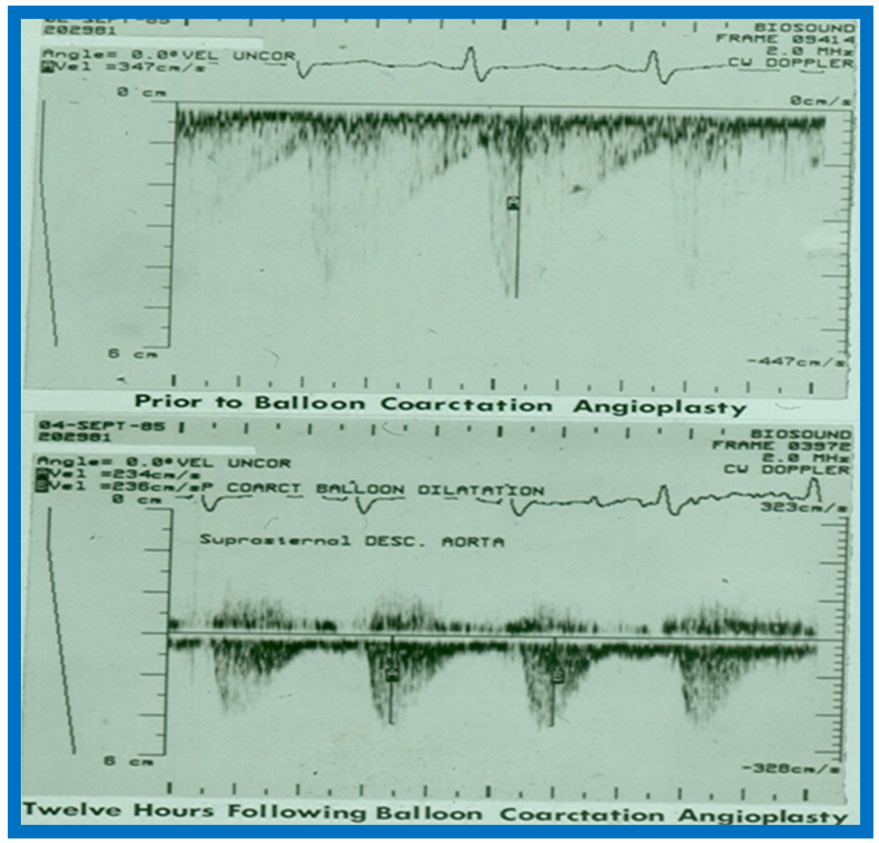 Children 07 00032 g053