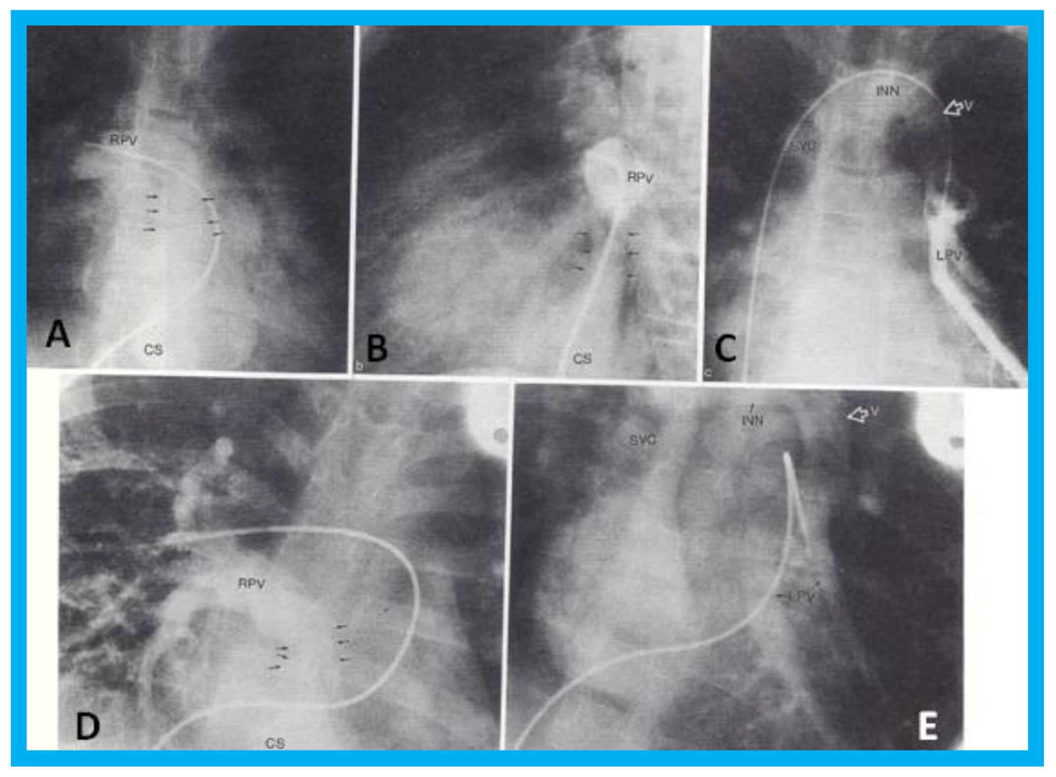 Children 07 00034 g007