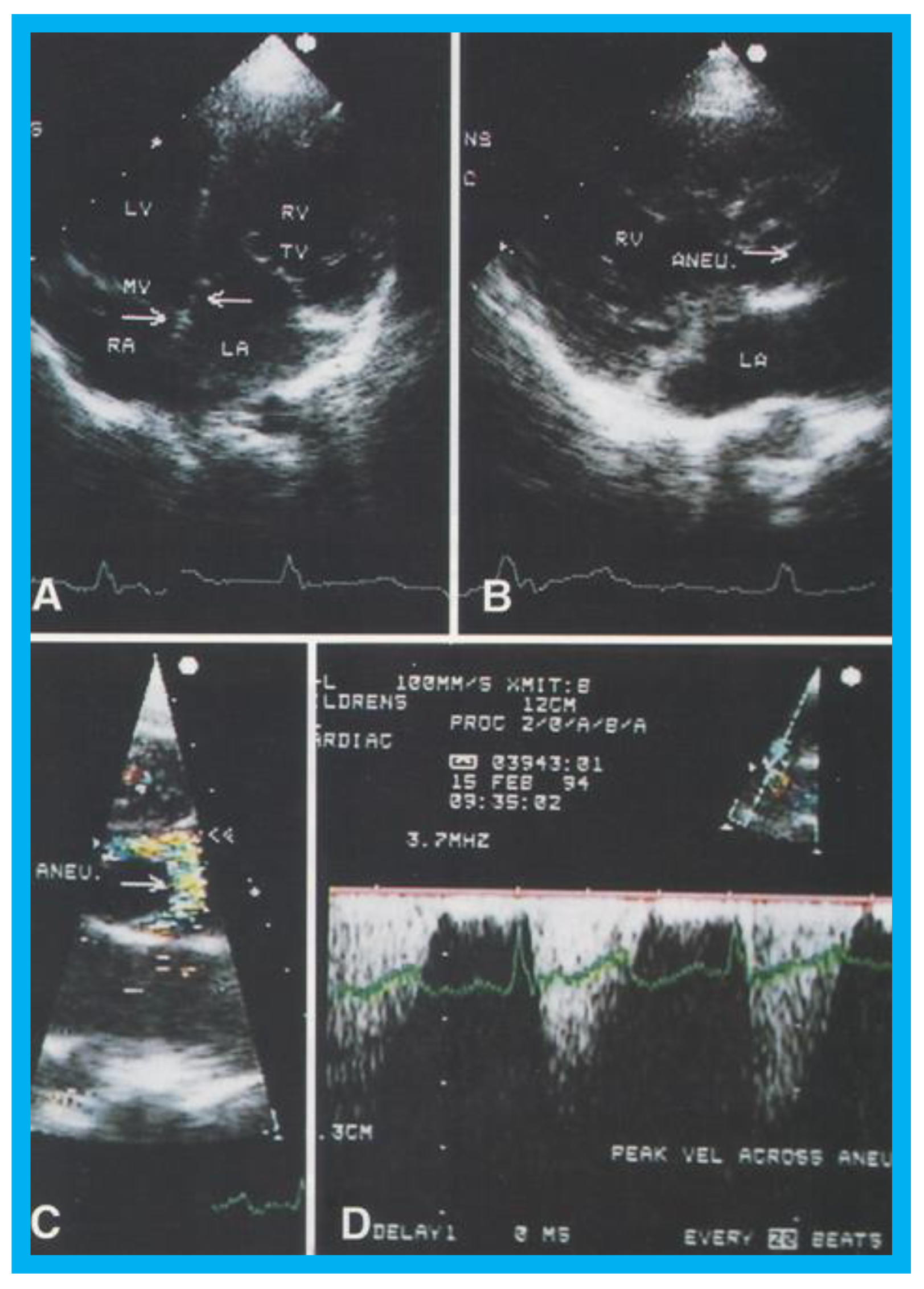 Children 07 00034 g017