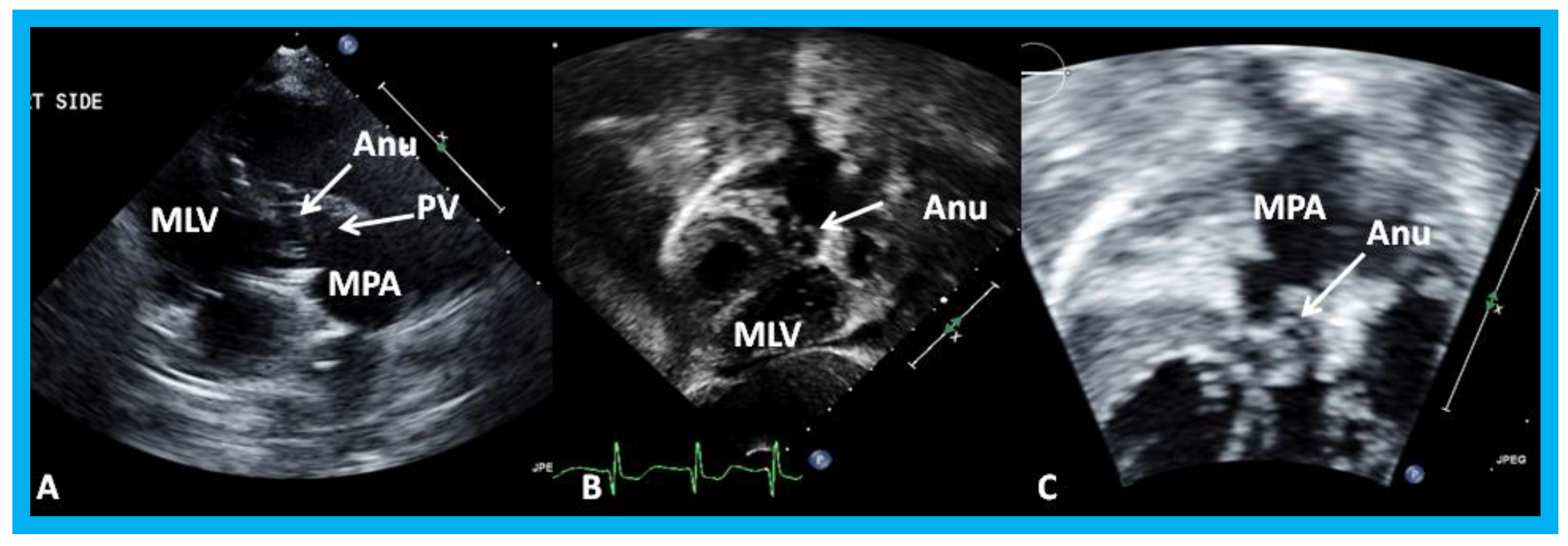 Children 07 00034 g019