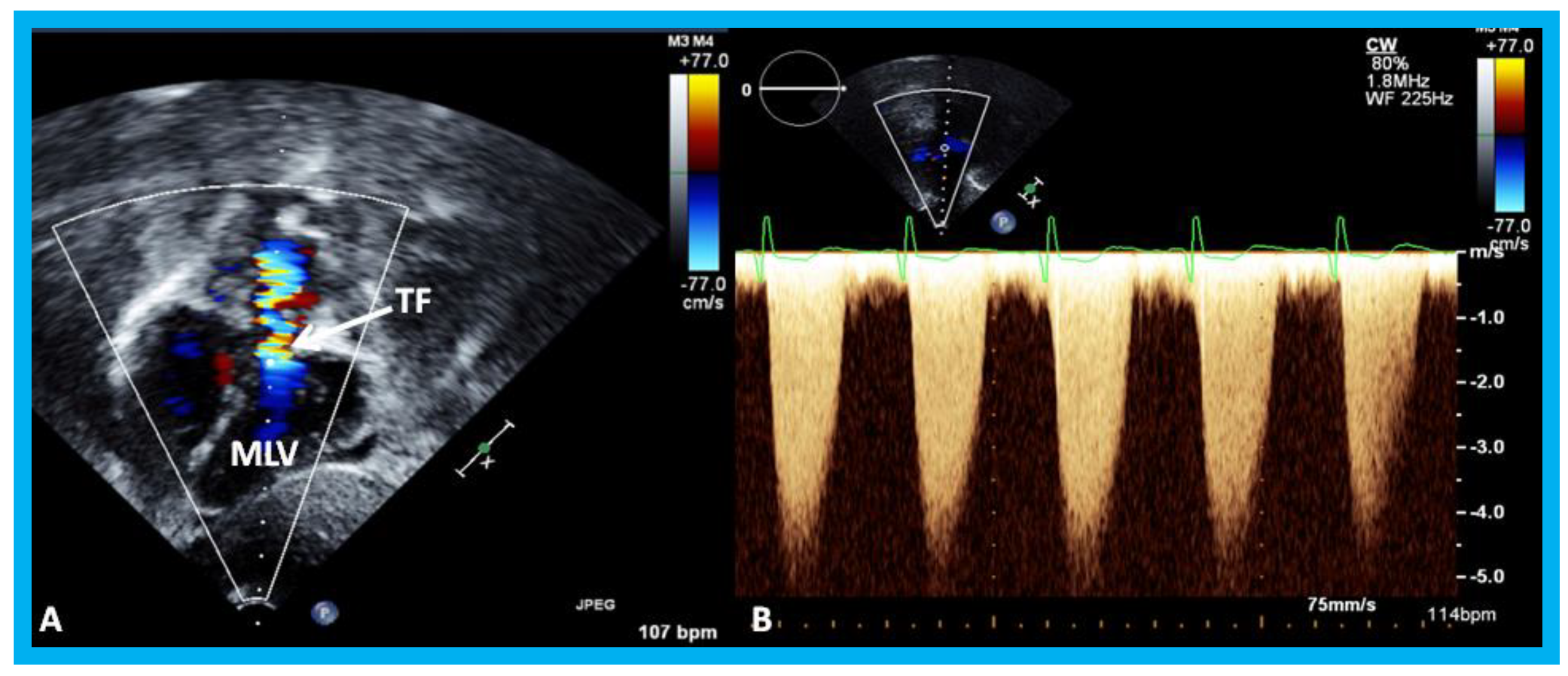 Children 07 00034 g020