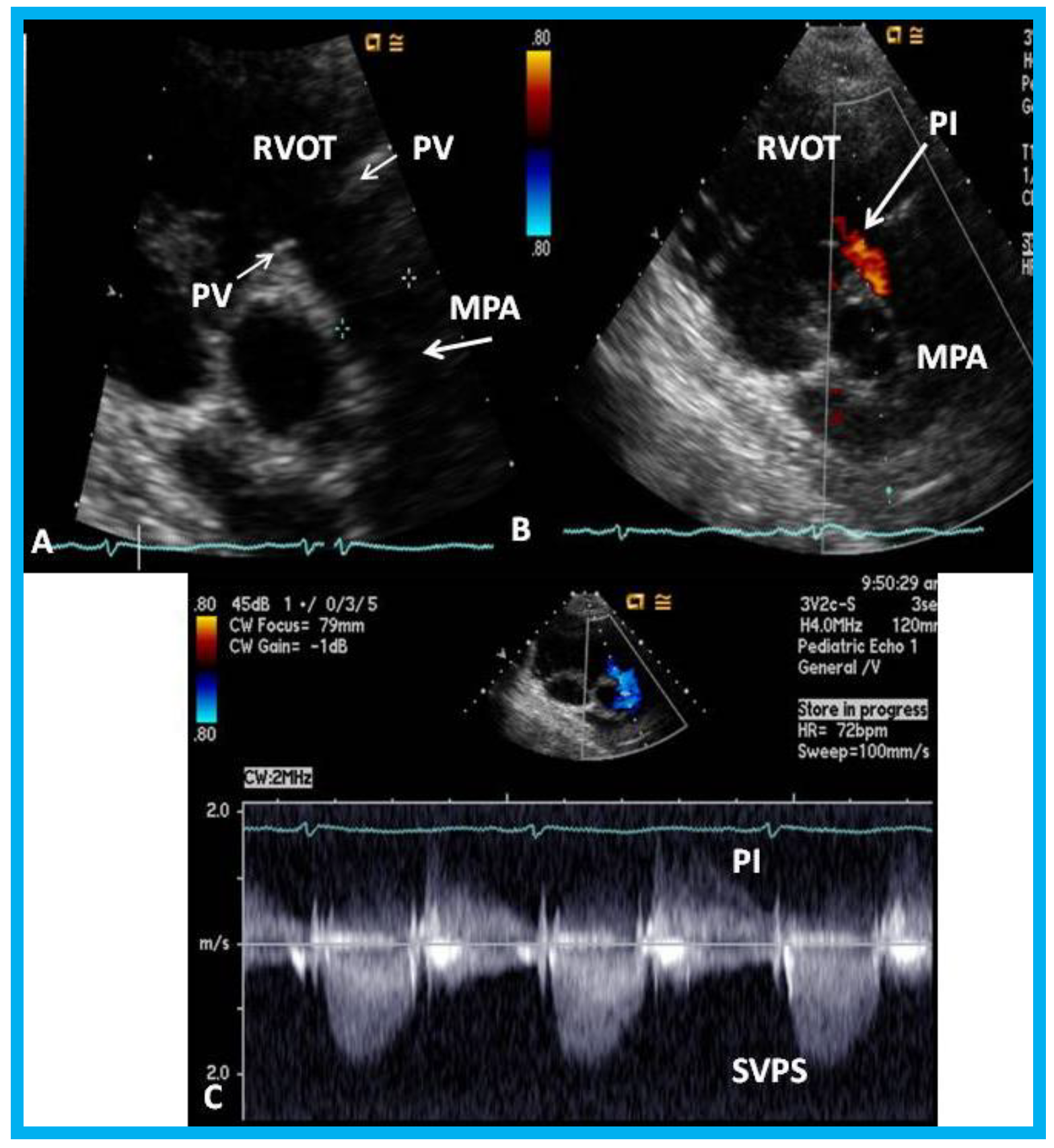 Children 07 00034 g022