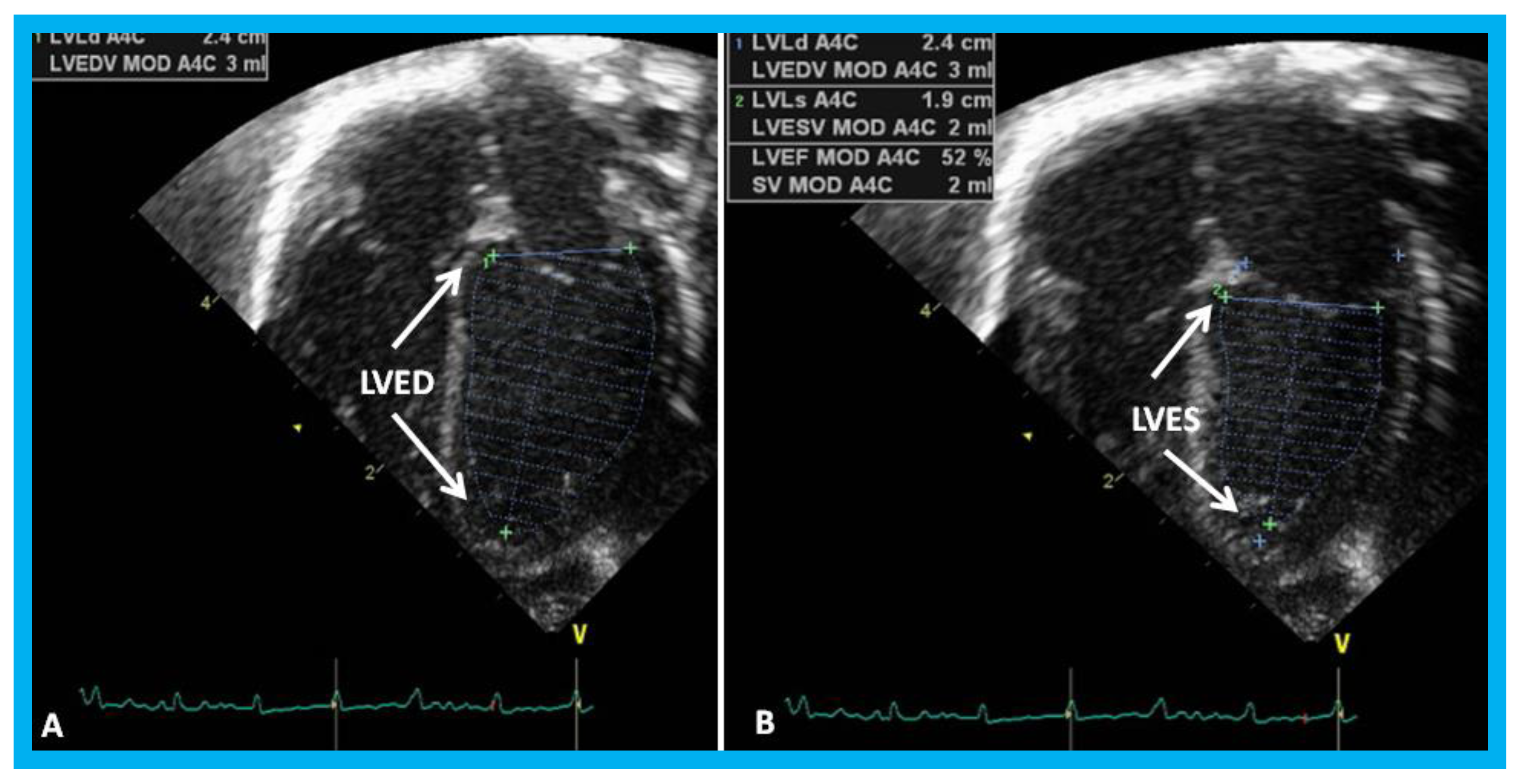 Children 07 00034 g024