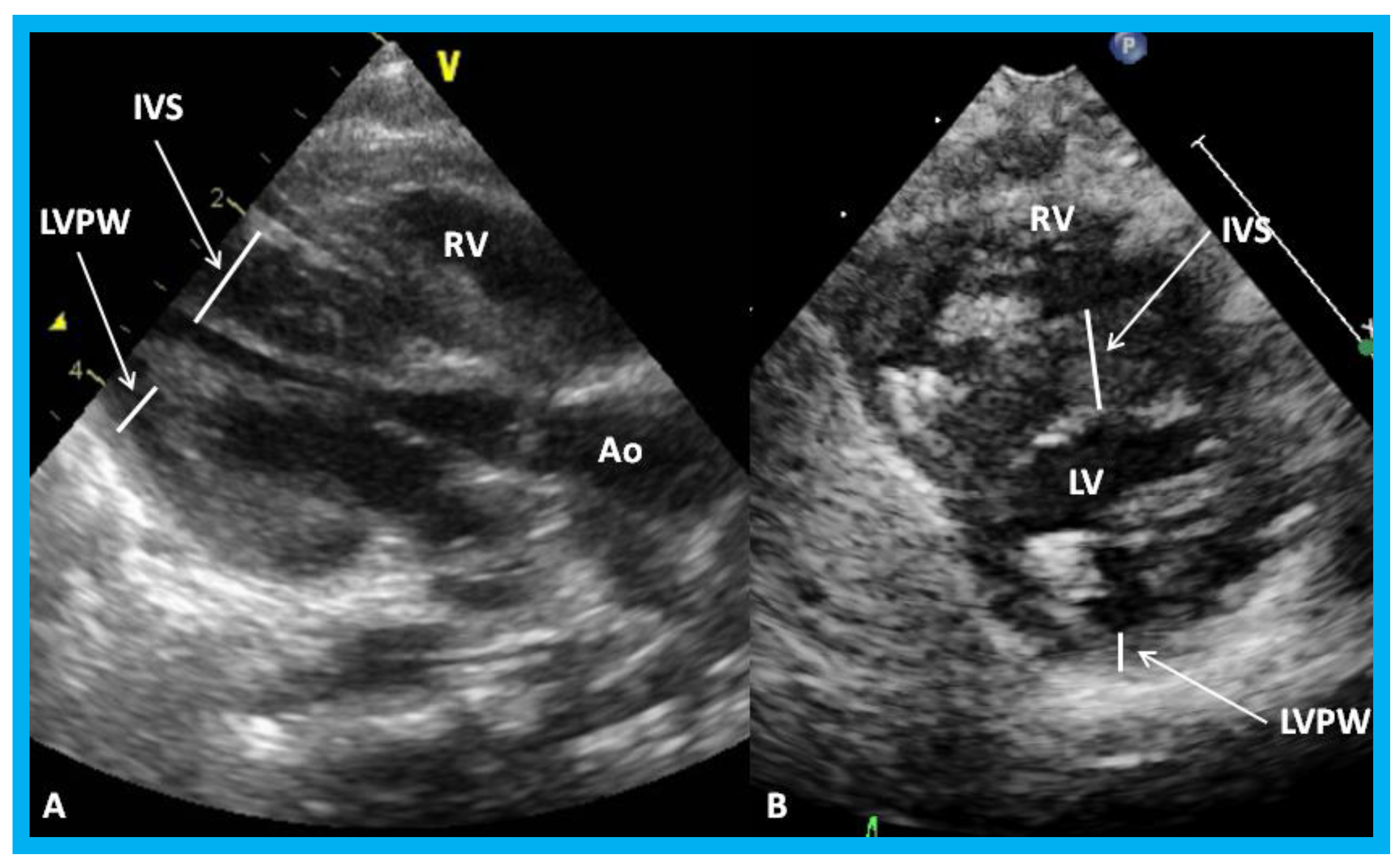 Children 07 00034 g025