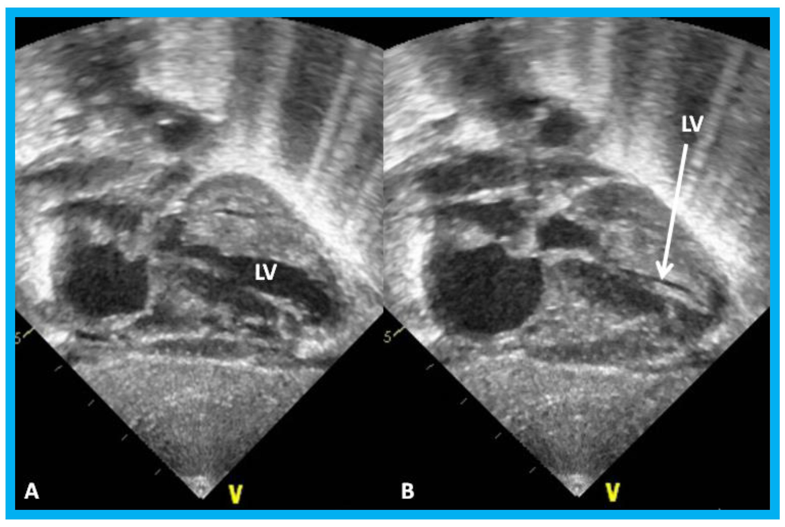 Children 07 00034 g026