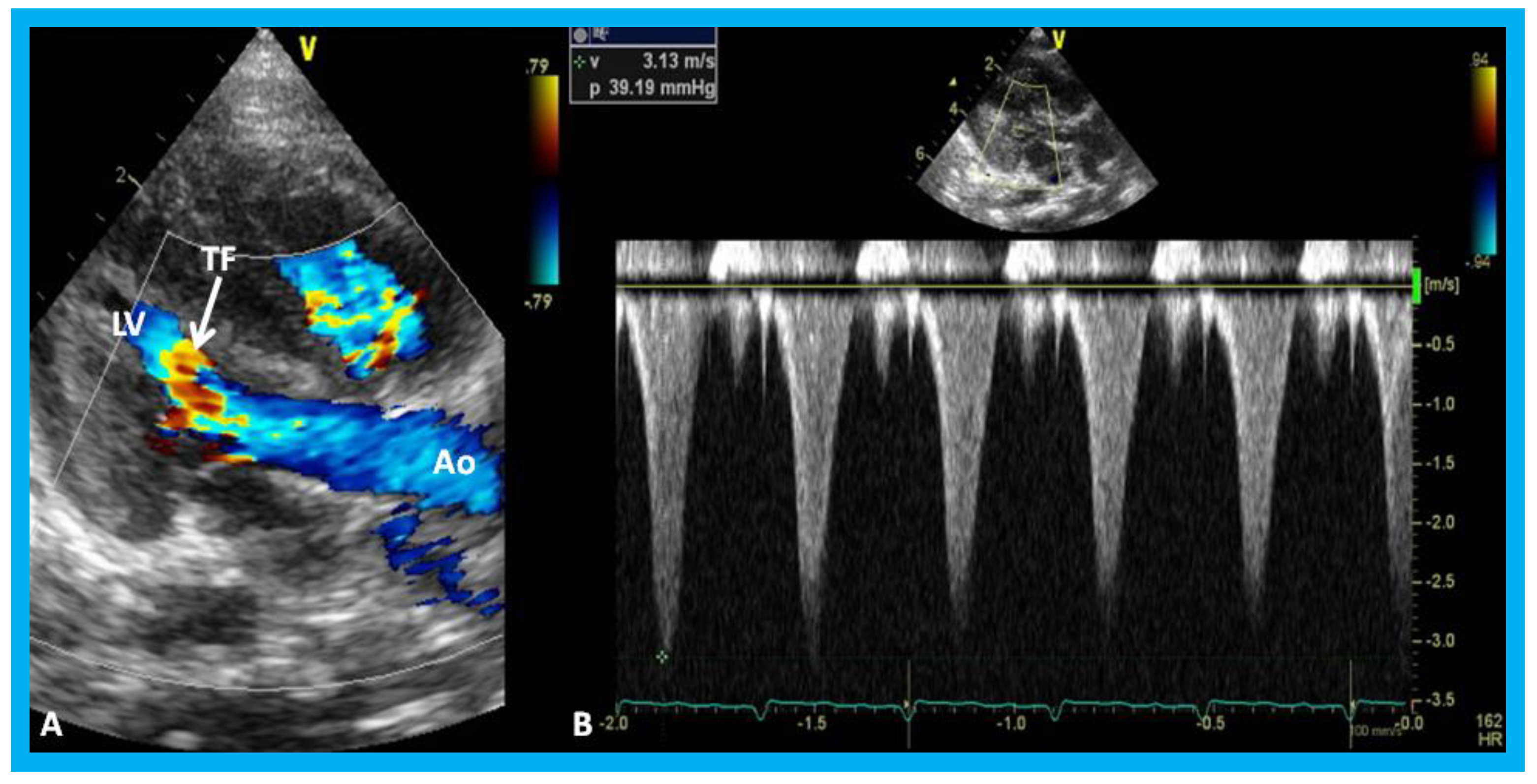 Children 07 00034 g027