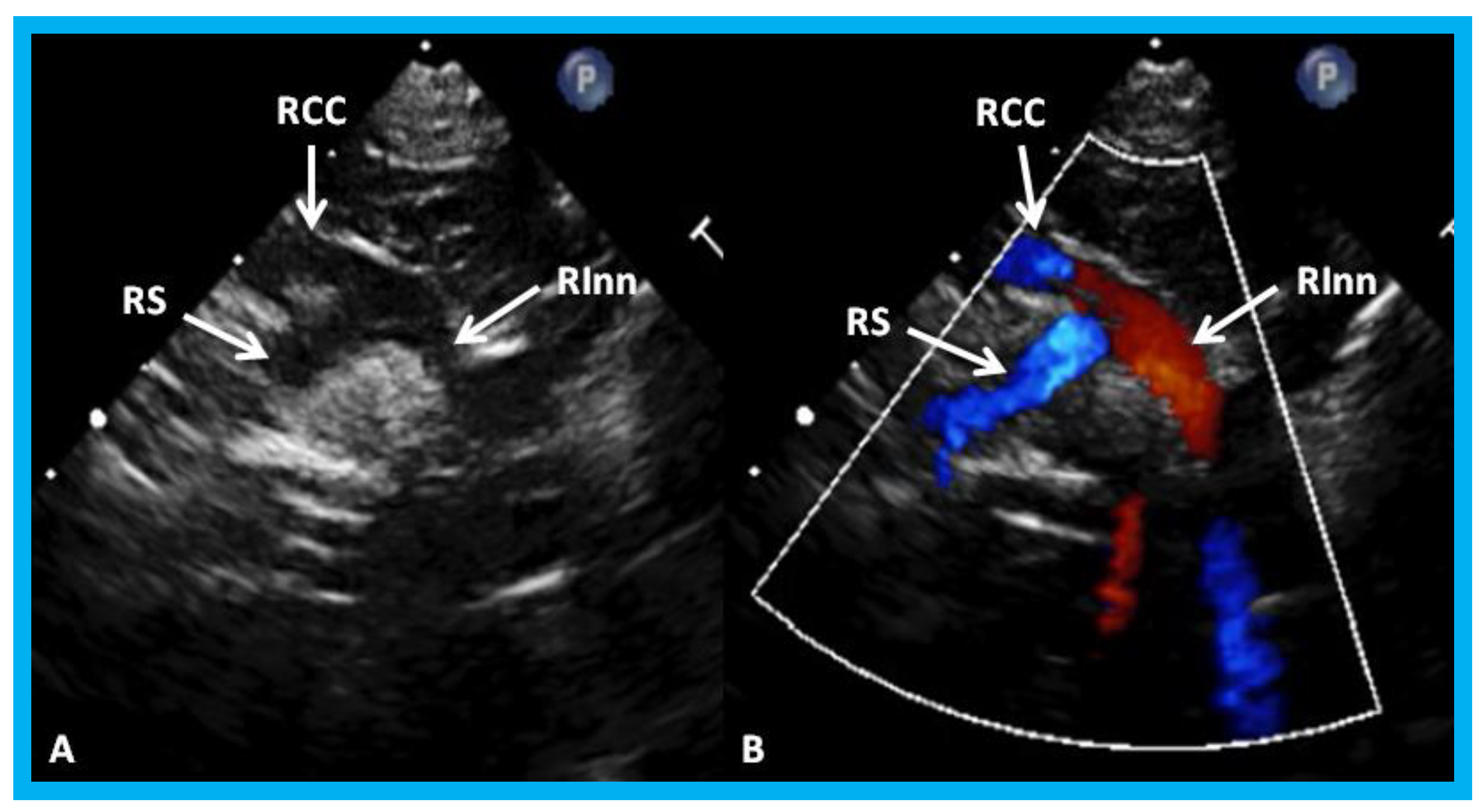 Children 07 00034 g028