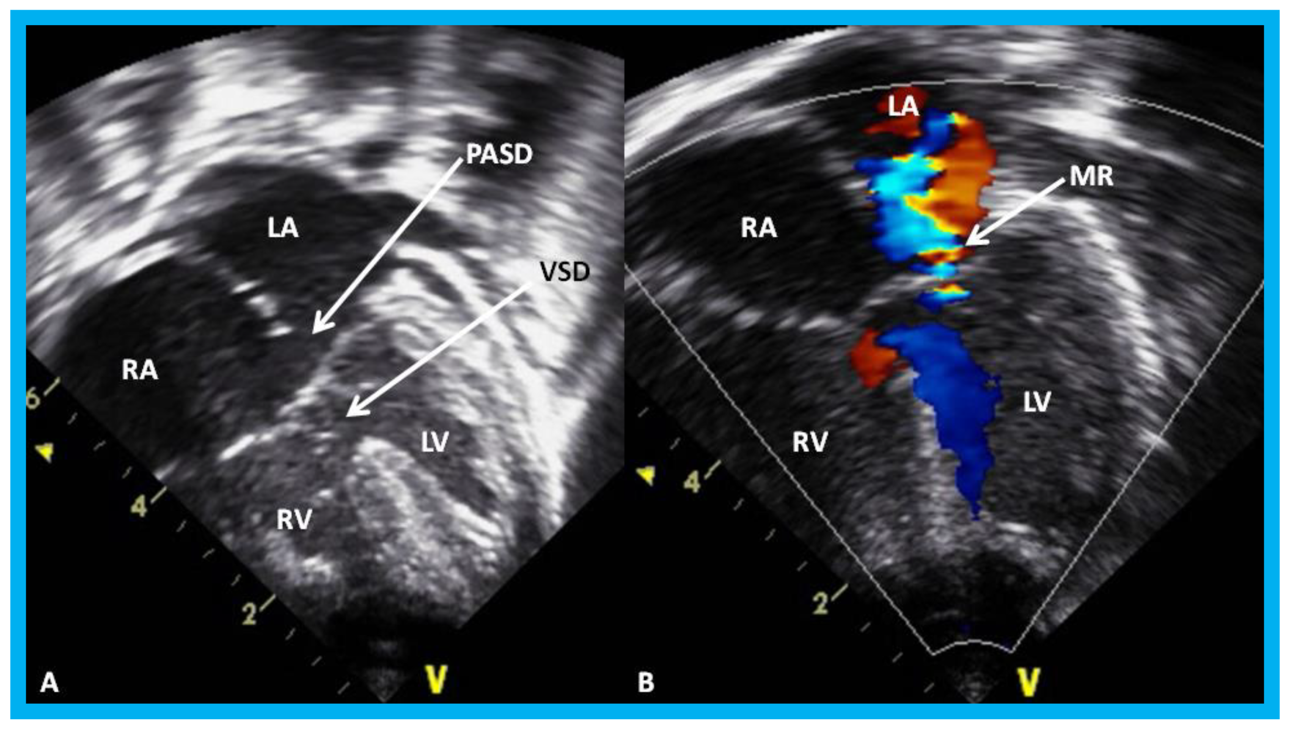 Children 07 00034 g029