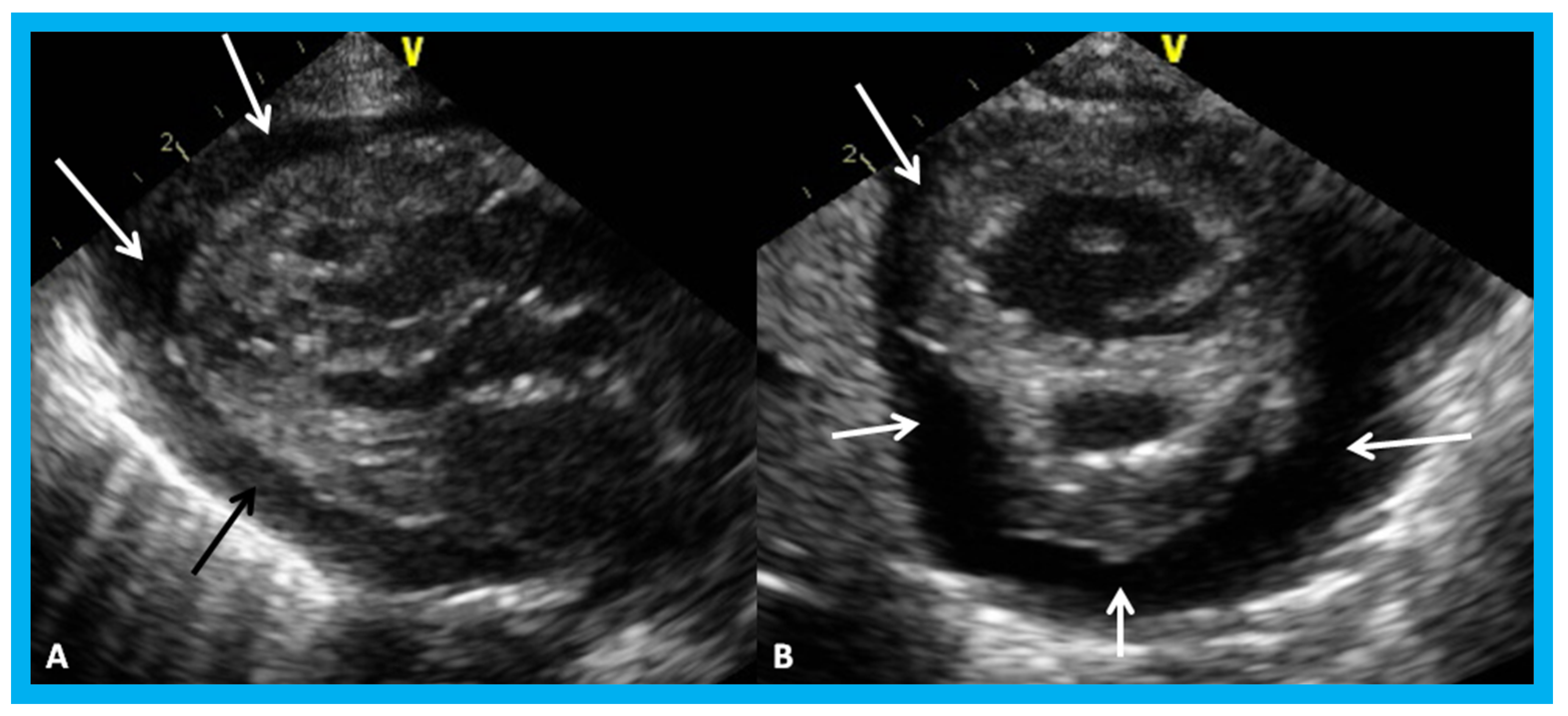 Children 07 00034 g031