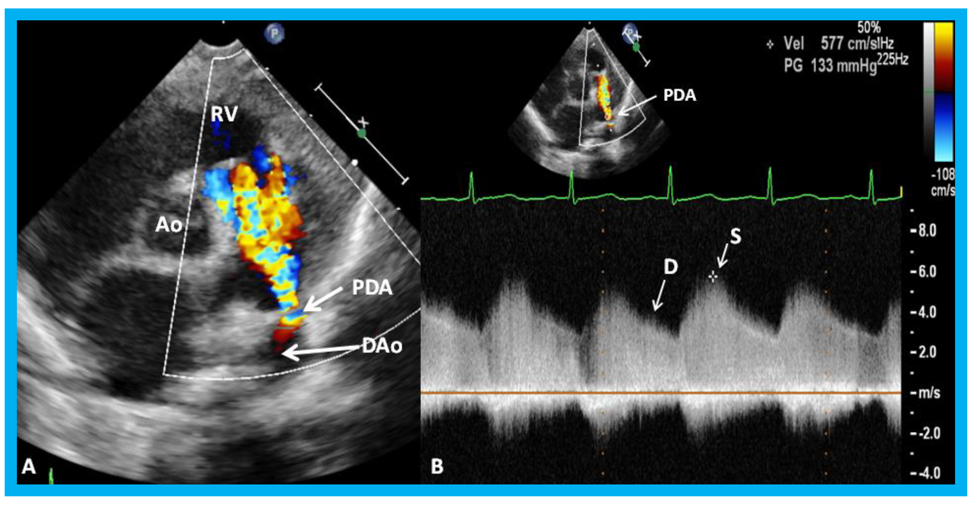 Children 07 00034 g032