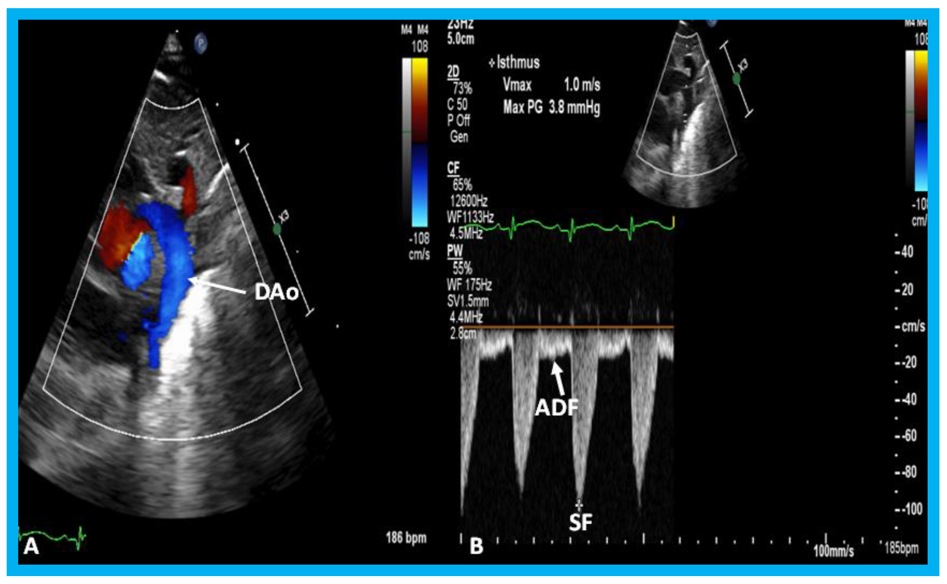 Children 07 00034 g034