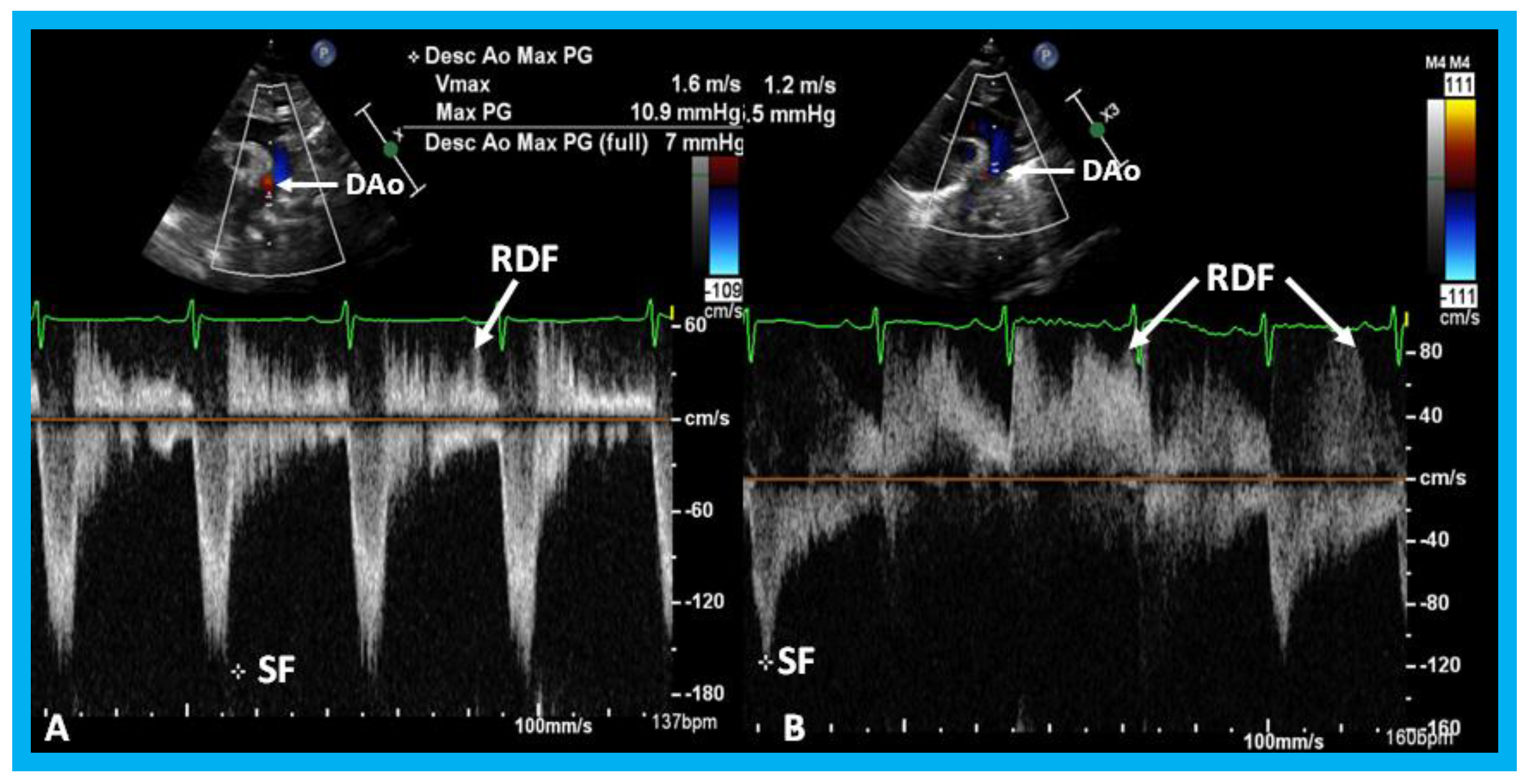 Children 07 00034 g035