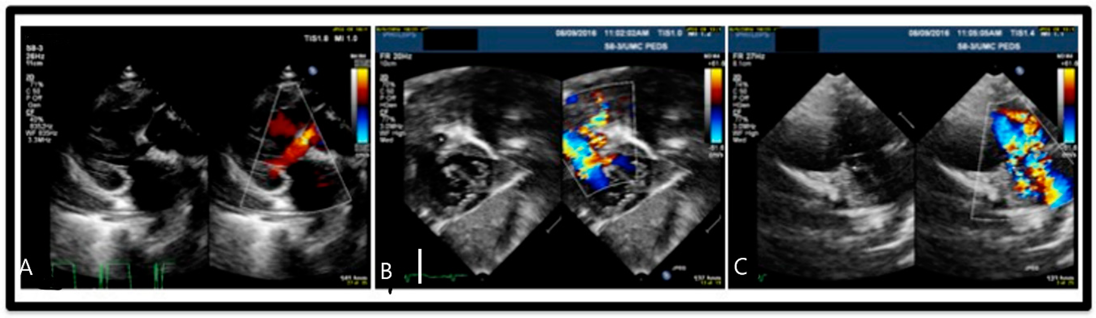 Children 07 00113 g002