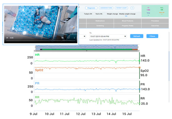 Children 08 00001 g0a6