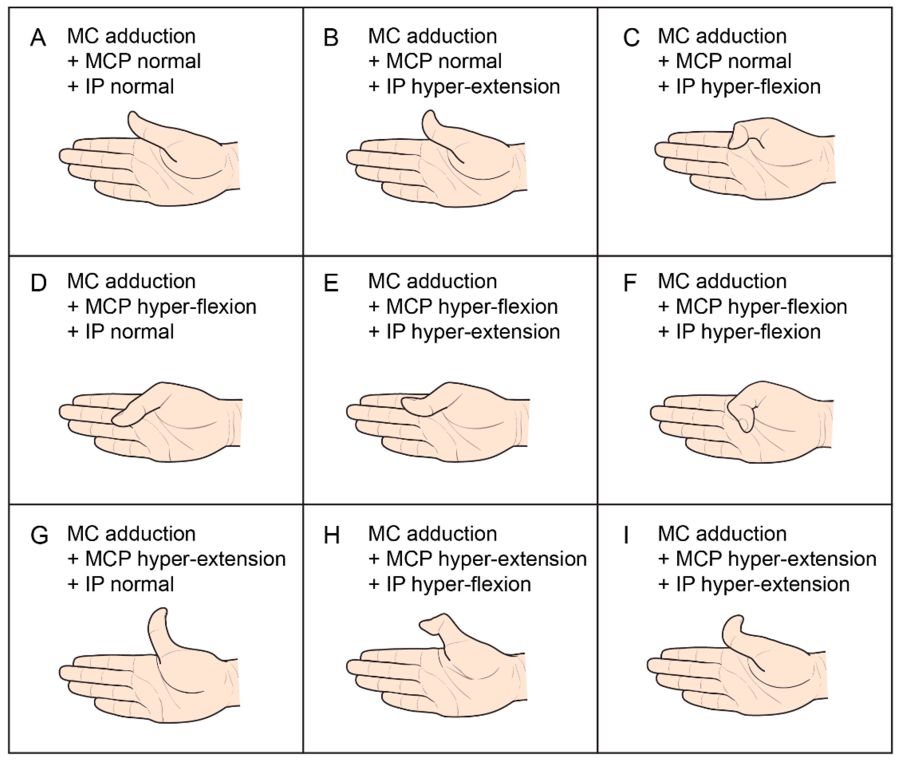Children 08 00017 g001